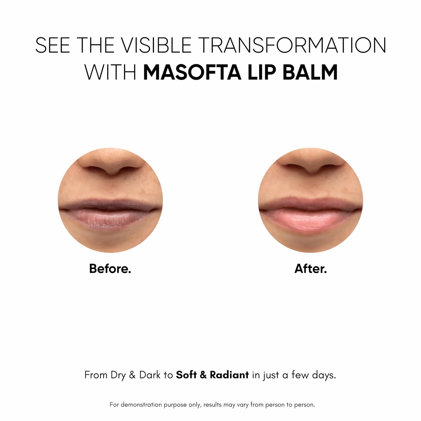 Masofta Shea Butter Lip Balm with Kojic Acid, Alpha Arbutin & Shea Butter for Smooth, Crack Free & Clear Lips, SPF 30 PA++, For Men & Women, 0.52 oz/15GMS