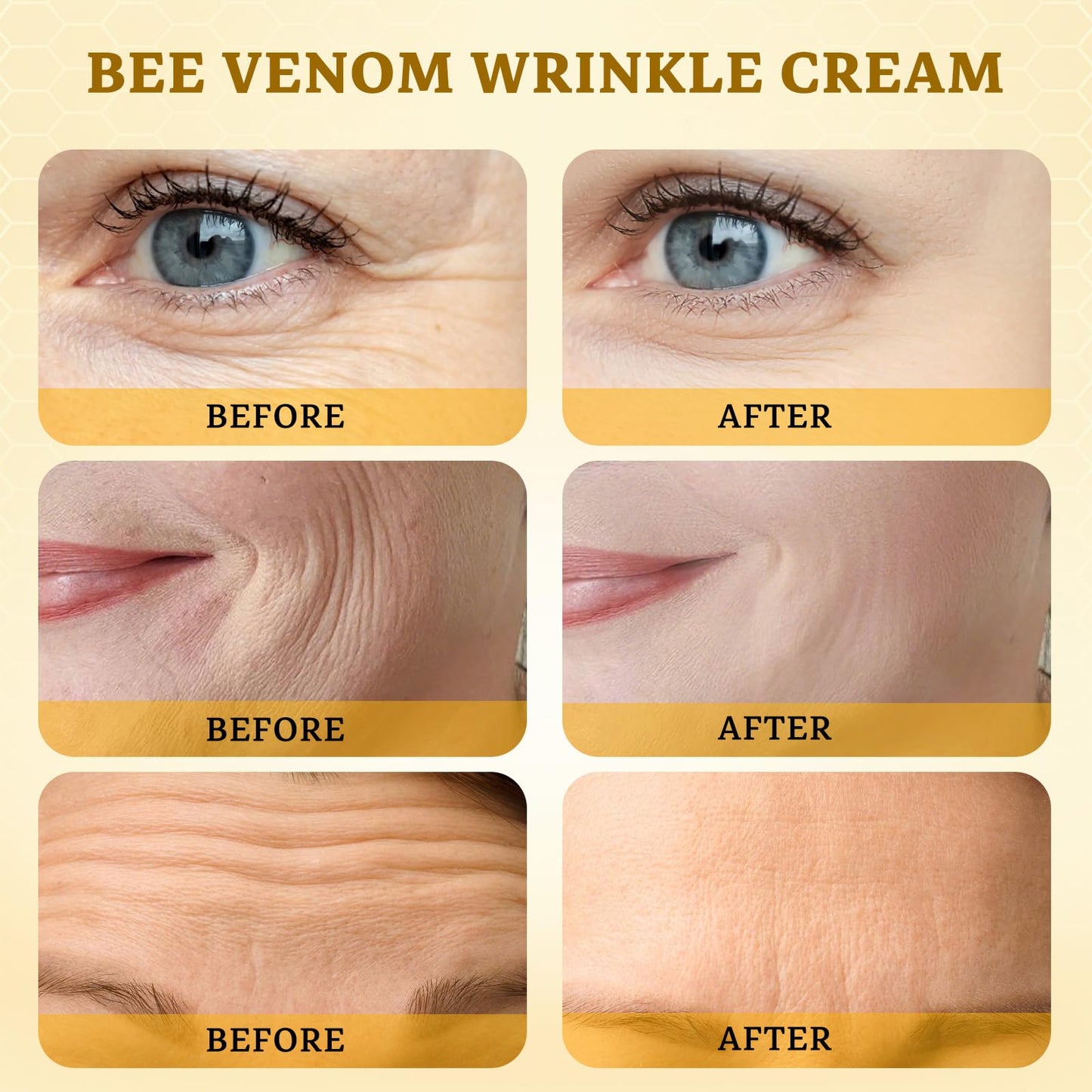 2PCS Bee Venom Comprehensive Cream: Wrinkle Care Face Lift & Firming, Effective In Reducing Skin Blemishes, Natural Care and Non-Irritating, Bee Venom Joint Cream for All Body Parts