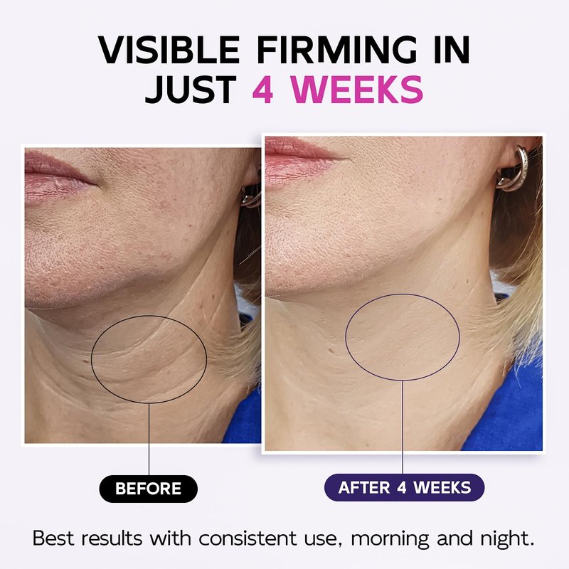 Neck Firming Cream New Formula, Tightening & Lifting Moisturizing Cream for Neck and Chest, Smooths Wrinkles & Crepey Skin, Visibly Firming, Multi-Peptide, Retinol, Collagen, Hyaluronic Acid 4.3 fl oz