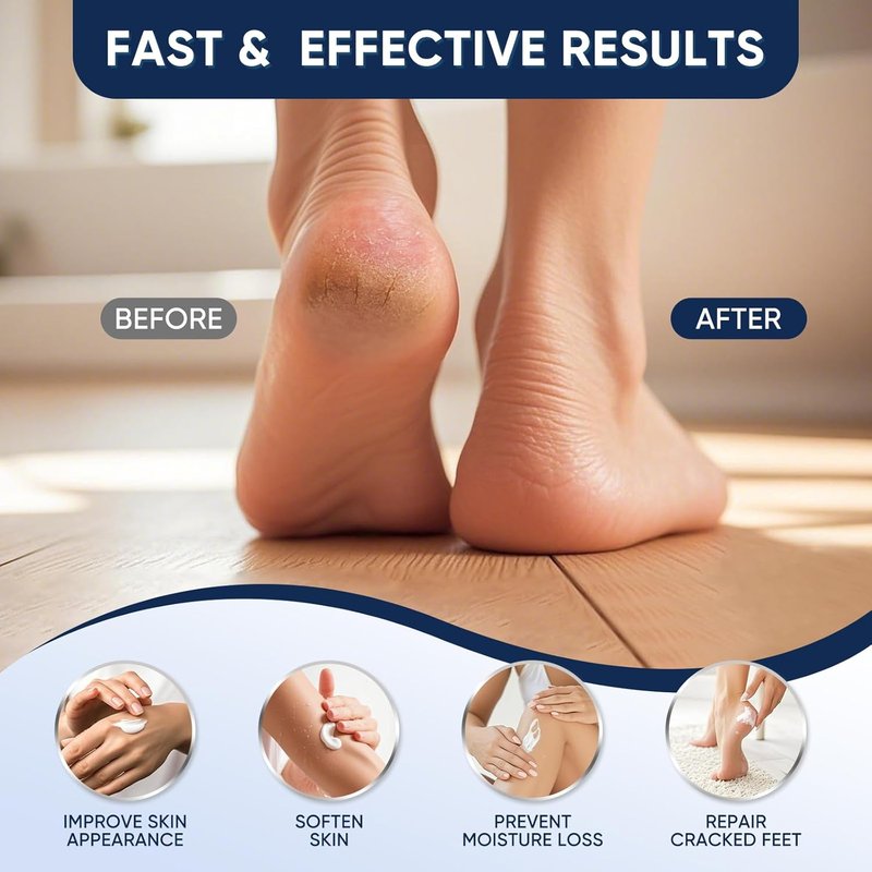 Urea Cream 40% - Maximum Strength Foot & Hand Cream with Salicylic Acid for Dry, Cracked Skin | 4 oz