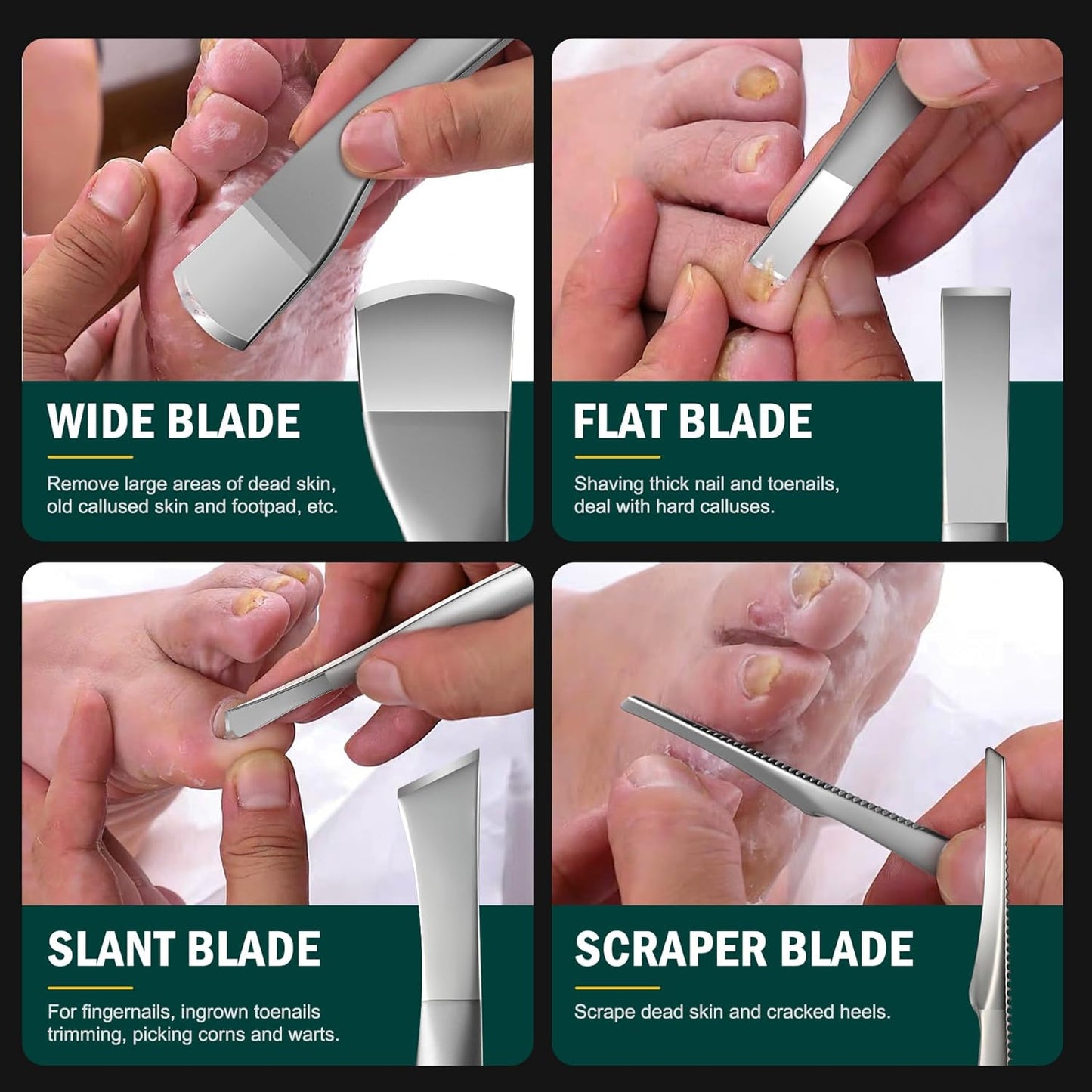 Professional Pedicure Knife Set - 4PCS Ingrown Toenail Removal Blades Kit | Stainless Steel Callus Shaver - Silver