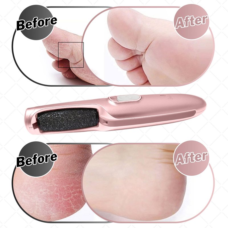 Powerful Electric Callus Remover Wand – Rechargeable Foot File, Grinder & Scrubber - Removes Dead, Hard Skin & Calluses – Best Pedicure Tool for Soft, Smooth Feet for Men & Women (Rose Gold)