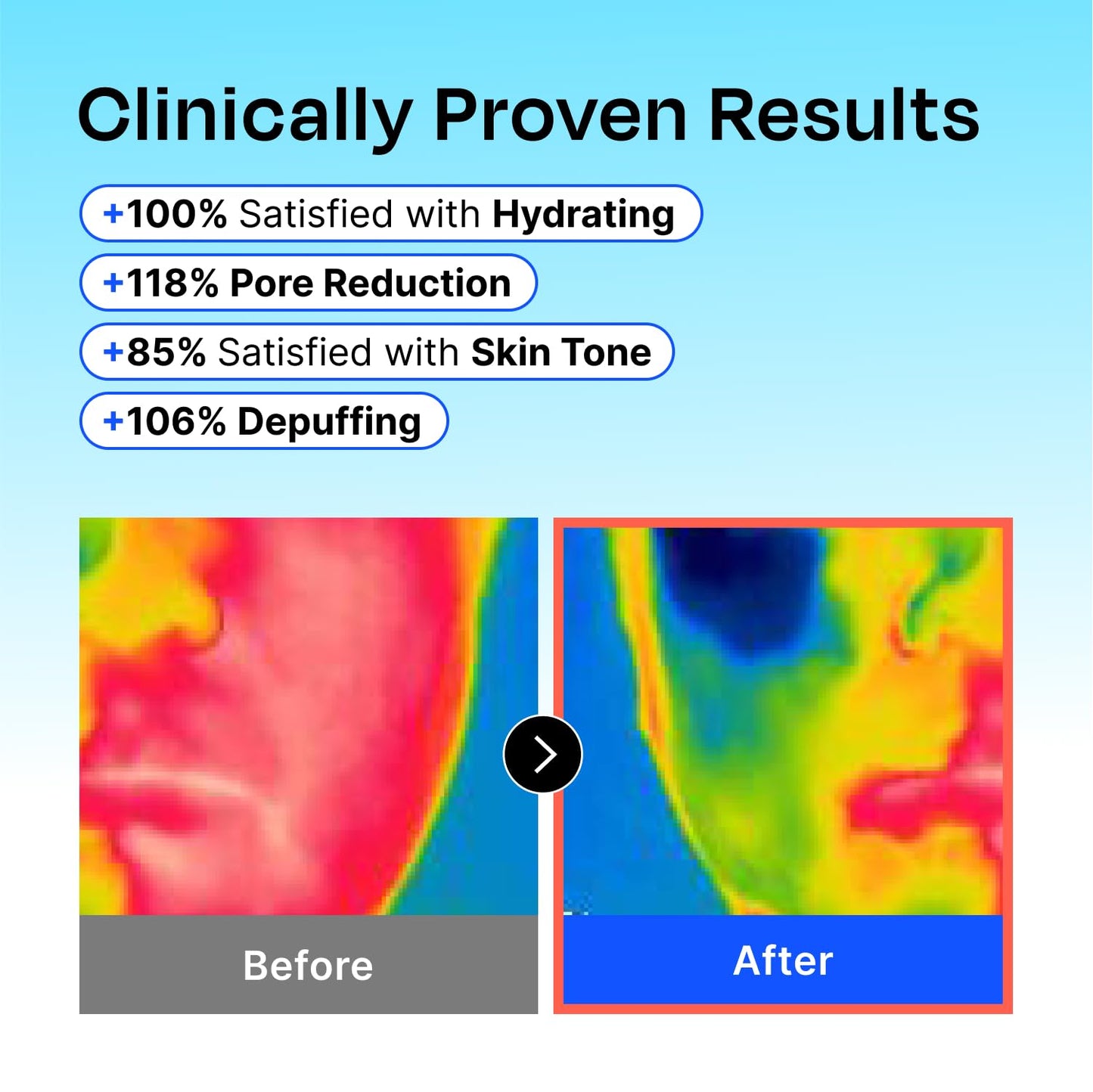 Celladix Hyaluronic Frozen Sherbet Mask – 95% Pure Hyaluronic Acid with Niacinamide & AHA – Instant Cooling for Morning Depuff, Hydration, Lifting & Pore Refining – Korean Skincare, 9 Pods 4.22 Fl Oz