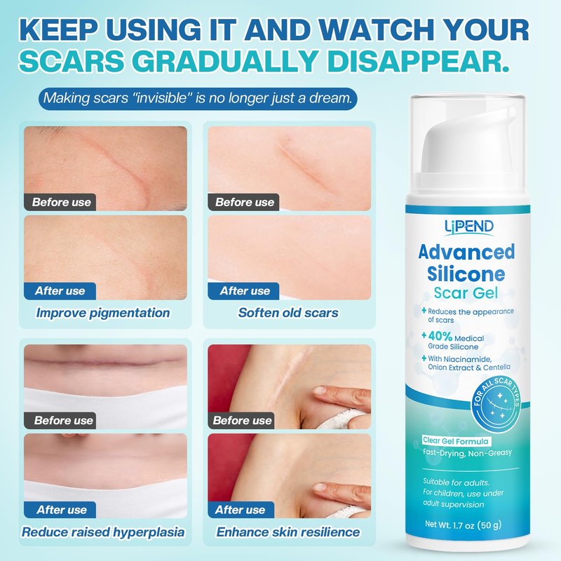 Advanced Silicone Scar Cream Gel Scar Removal for Old and New Treatment Remover Fading Surgical Face Burn C Section Heal Fast Acne Keloid for Men and Women Improve the Appearance 50g（1.76 Oz）/ 2 Pack