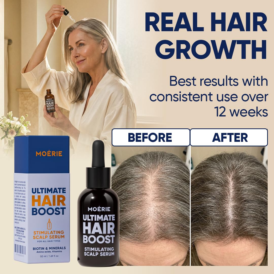 MOERIE Ultimate Hair Growth Serum for Natural Hair Regrowth & Thickening - Anti Thinning & Hair Loss Treatment for Women - Rapid Hair Growth Products - Scalp Oil Alternative - 1.69 fl oz, 2 pack