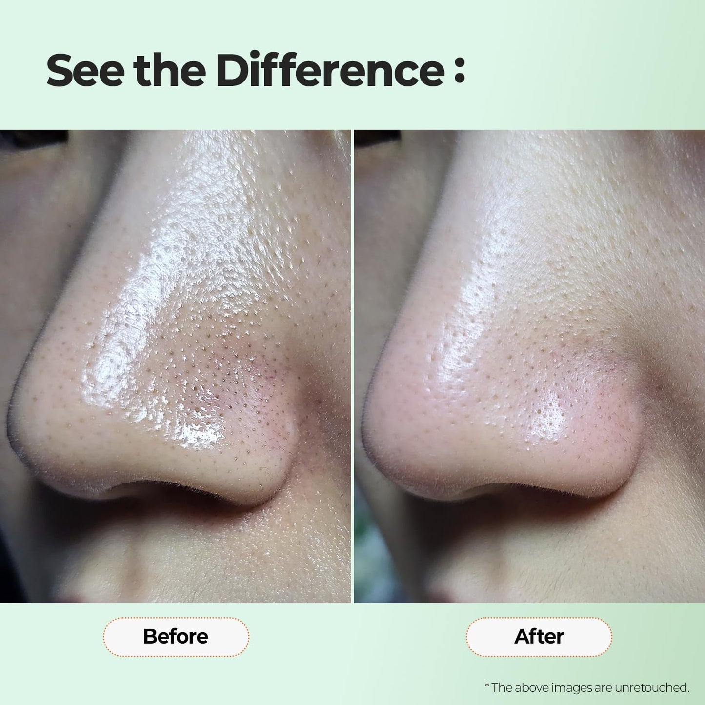 MOTHER MADE Green Tea-Rouble Away Clarifying Toner with AHA BHA PHA 150 ml