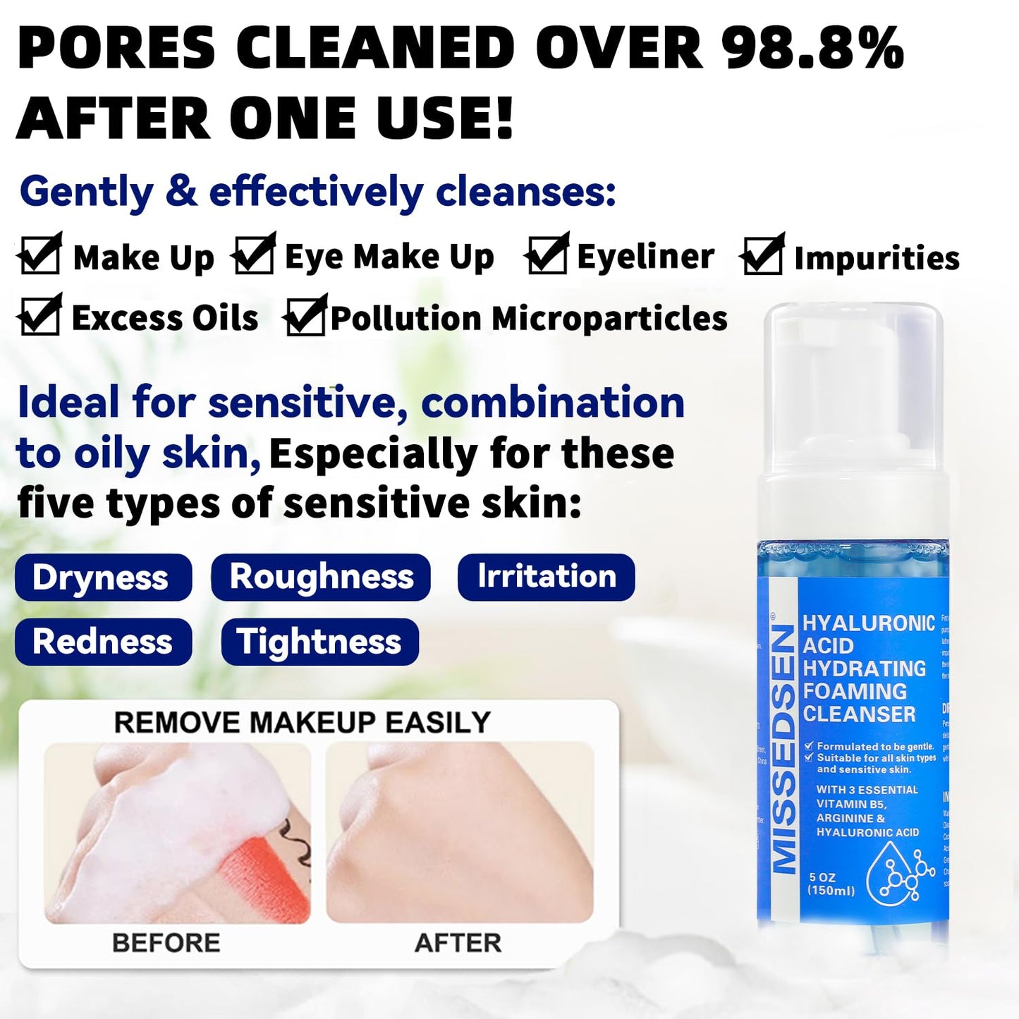 MISSEDSEN Face Wash for Acne and Oily Skin, Fragrance Free, 5 oz