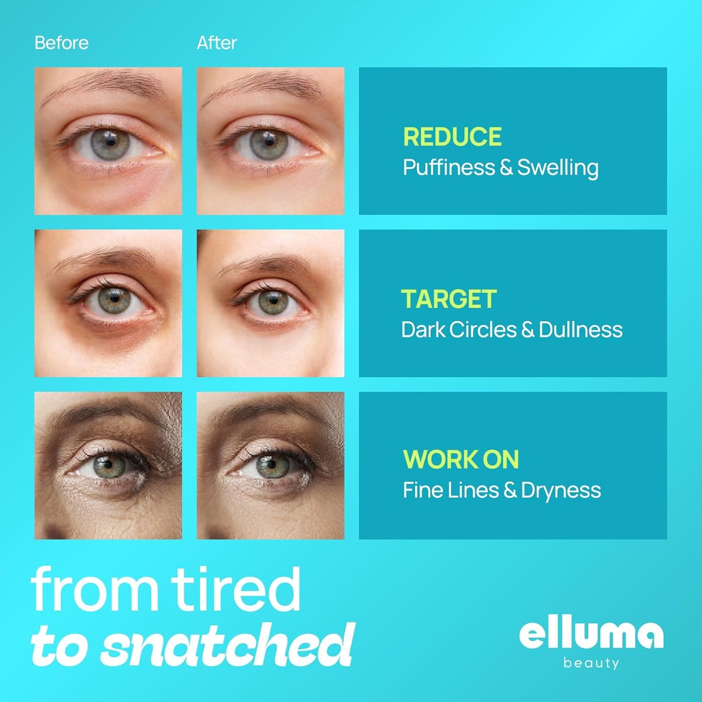 Hydrogel Under Eye Patches - 12 Pairs for Puffy Eyes, Dark Circles & Wrinkles | Hydrating with Seaweed Extracts