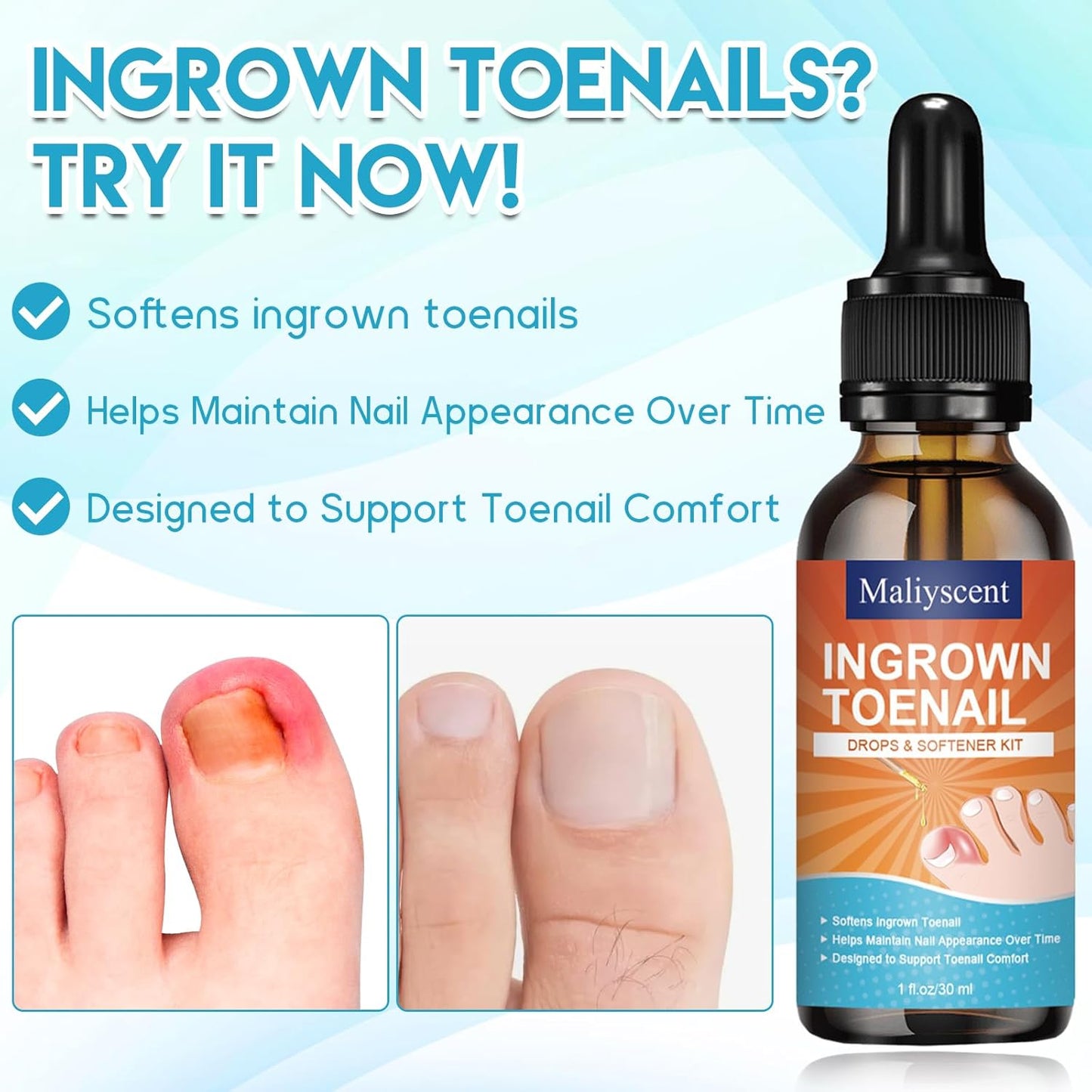 Ingrown Toenail Removal Kit - Professional Tool Set with Corrector Drops, Clipper & Nail File | Complete Pedicure Solution