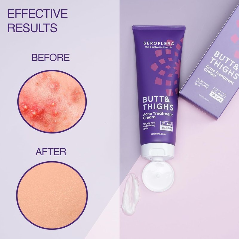 Butt Acne Cream & Razor Bump Serum | Reduces Ingrown Hairs, Bumps & Redness - Post-Shave Skin Comfort Bundle