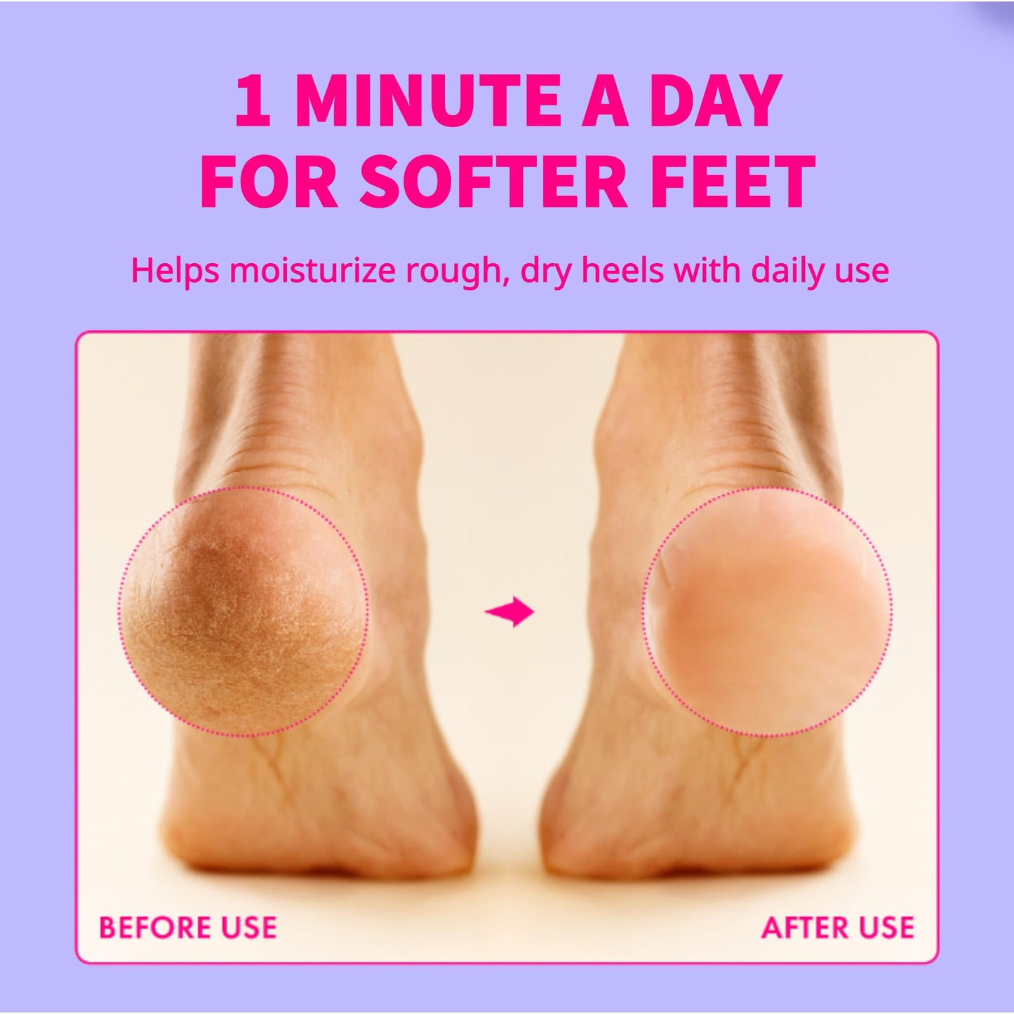 LOYNU Foot Care Deodorant Lotion – Long-Lasting Odor Control & Deep Hydration, Neutralizes Foot Odor, Moisturizes Dry, Cracked Heels, Mushroom Extract Formula for Soft, Healthy-Feeling Feet, 2PCS