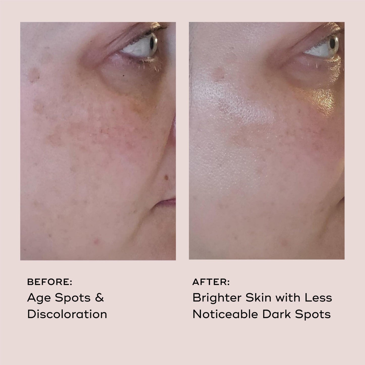 EVER Vitamin C Dark Spot Correcting Serum for Face – Anti Aging & Brightening Serum with 10% Vitamin C, Helps Fade Dark Spots, Age Spots & Uneven Tone (1 oz)