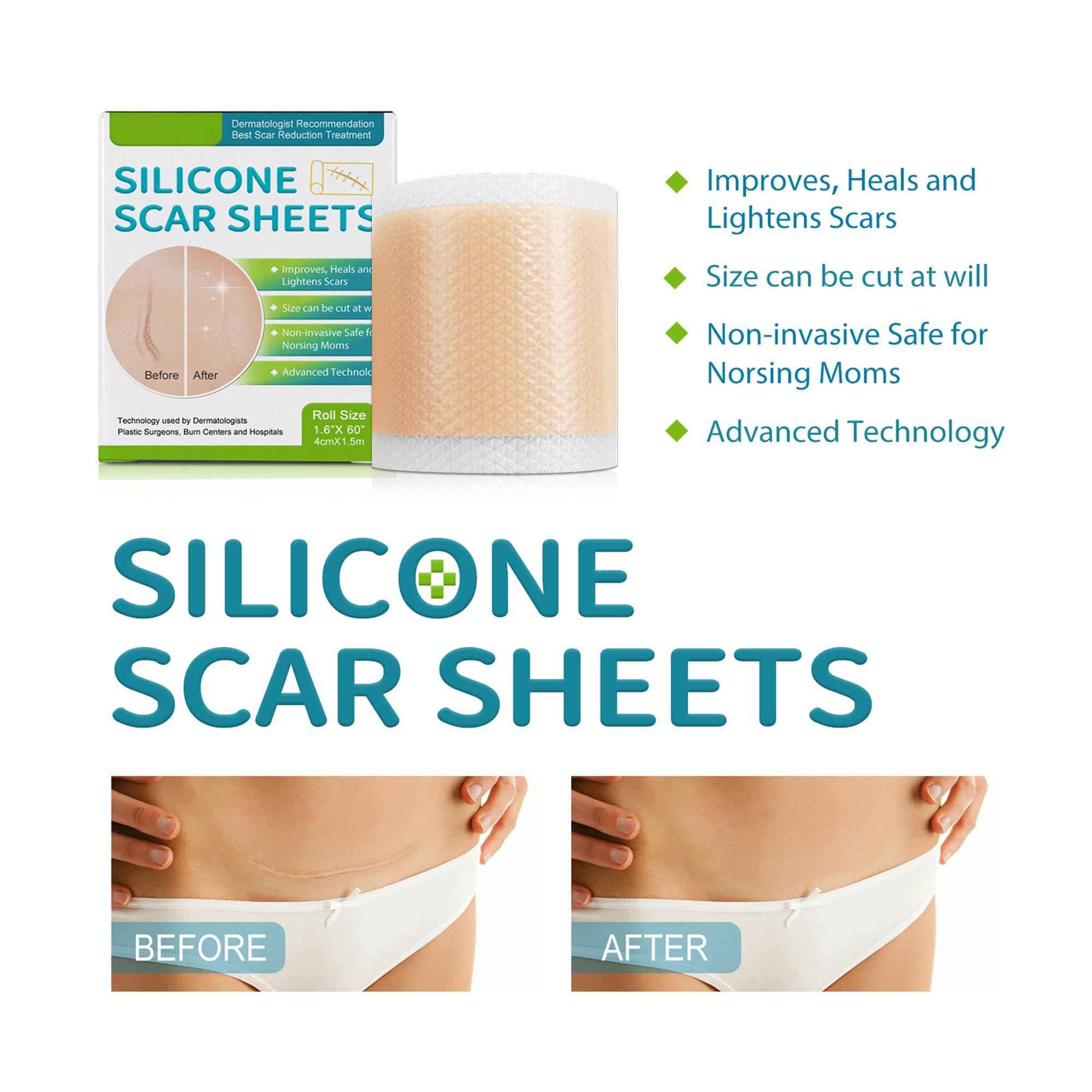 Silicone Scar Sheets - Suitable for Repair of Caesarean Section, Abdominoplasty, Keloid and Surgical Scars(1.6”x 60”)