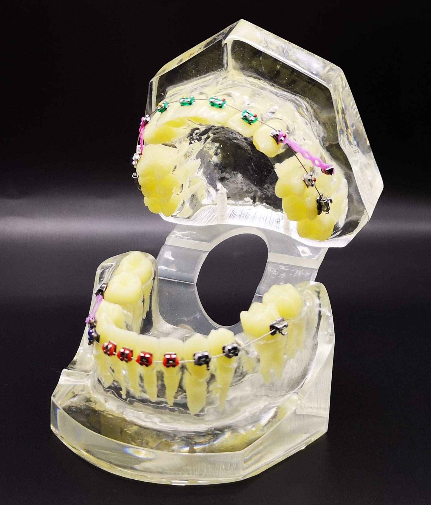 Dental Typodont with Metal Brackets Orthodontic Teeth Model with Ligature Tie