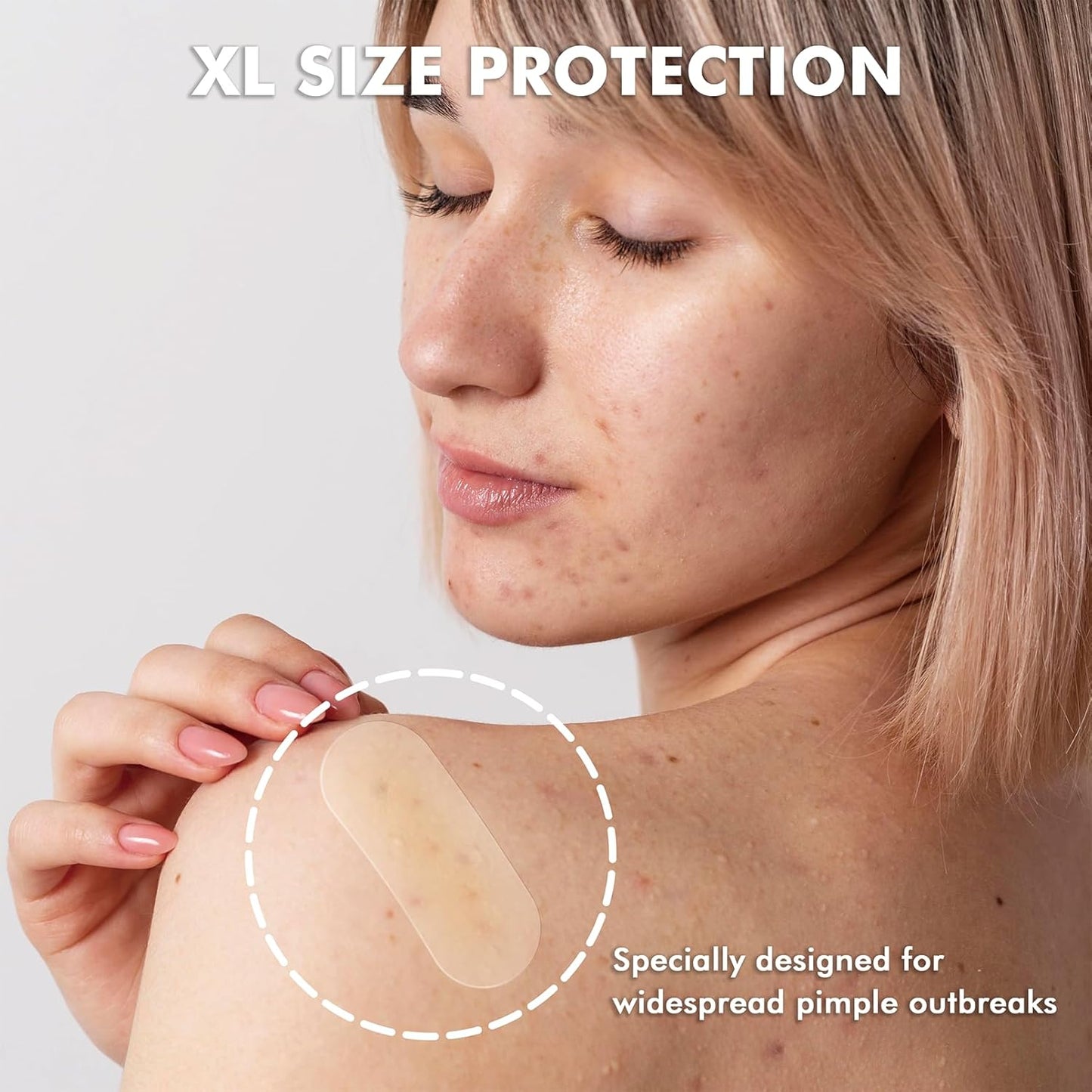 Albatross Health New England Invisible Pimple Patches for face, plain Hydrocolloid Acne Patches, HSA FSA eligible, Spot Dots Cover, Zit Blemish Patch, 2 Sizes 180 Counts