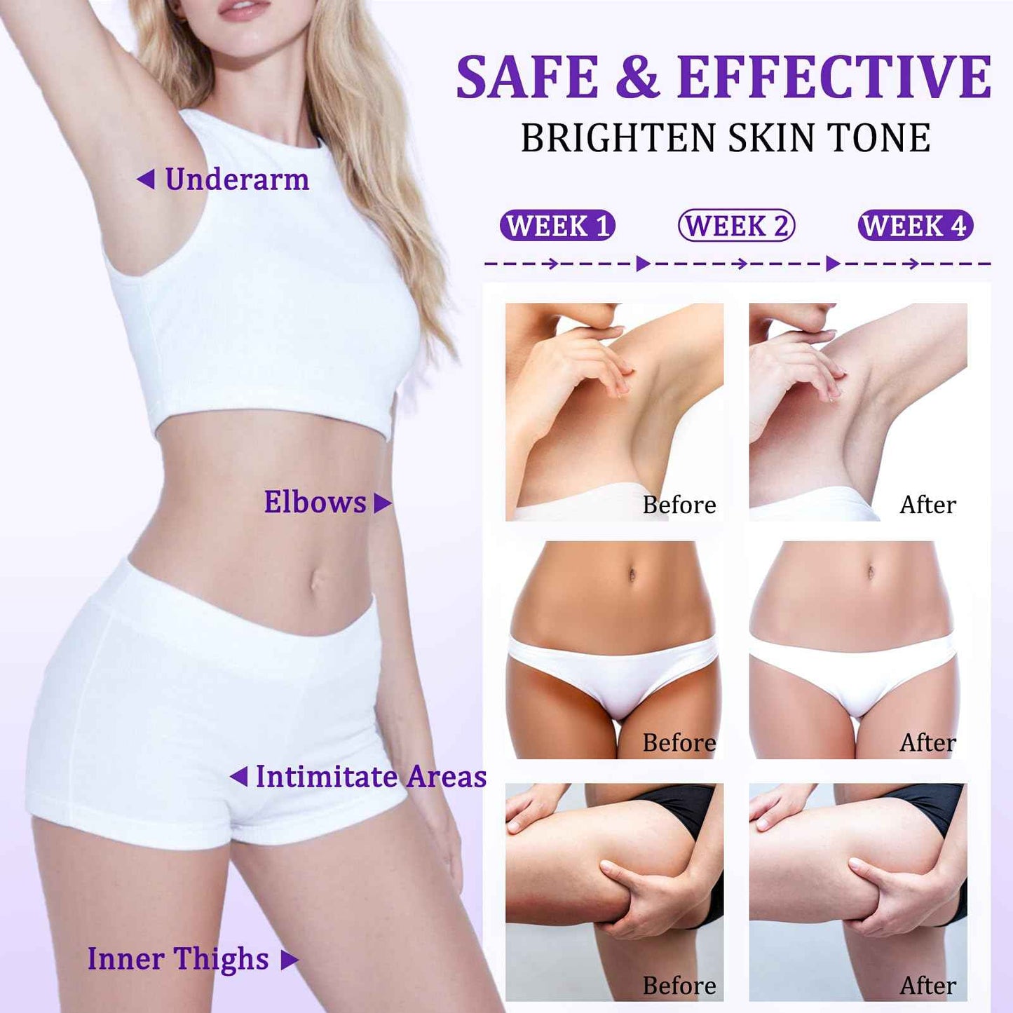 Dark Spot Remover for Body, Skin Bleaching Cream with Vitamin C for Intimate Areas, Skin Lightening Cream Dark Spot Corrector for Underarms, Knees, Face, Elbows, Inner Thighs & Bikini Line,1.7fl oz