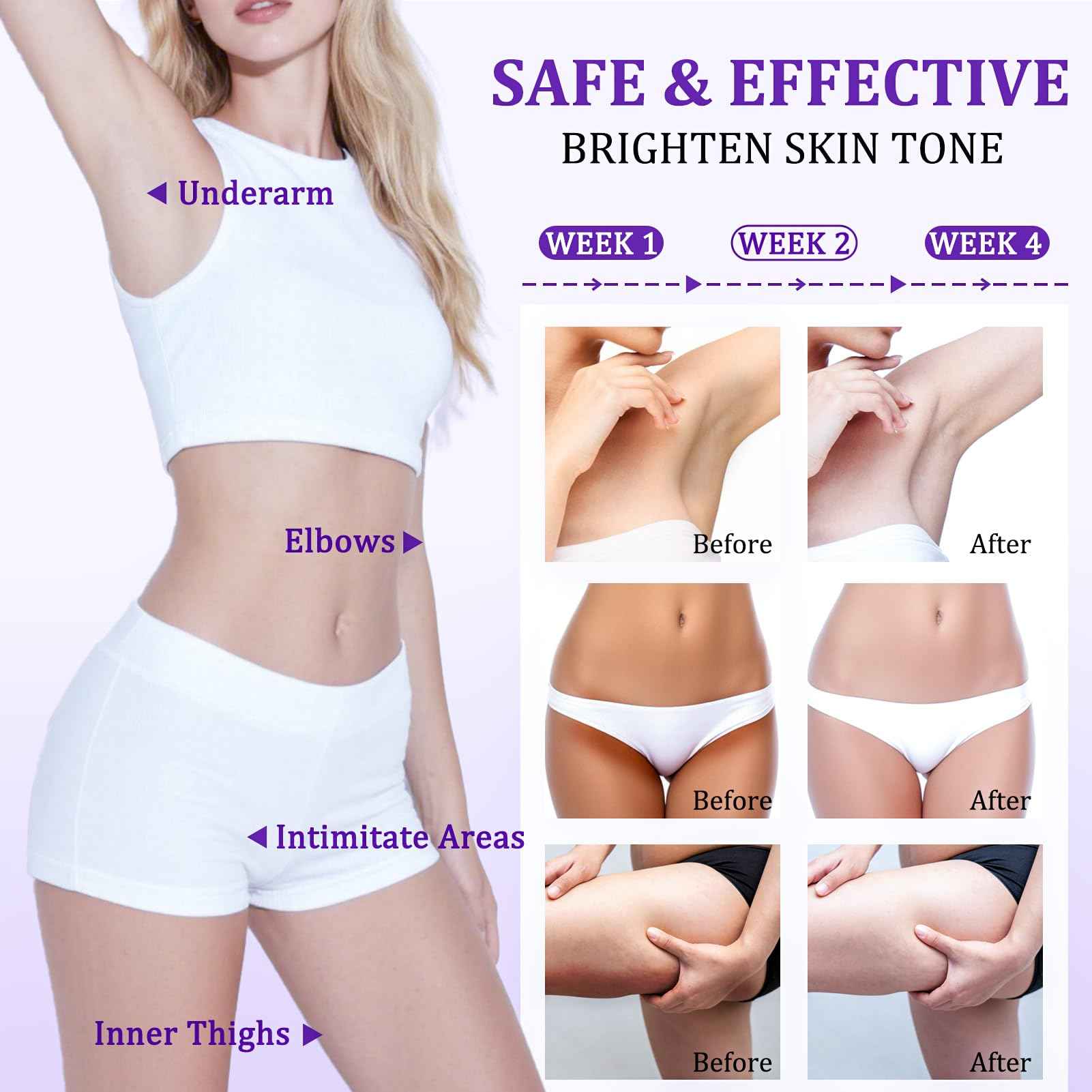 Dark Spot Remover for Body, Skin Bleaching Cream with Vitamin C for Intimate Areas, Skin Lightening Cream Dark Spot Corrector for Underarms, Knees, Face, Elbows, Inner Thighs & Bikini Line,1.7fl oz