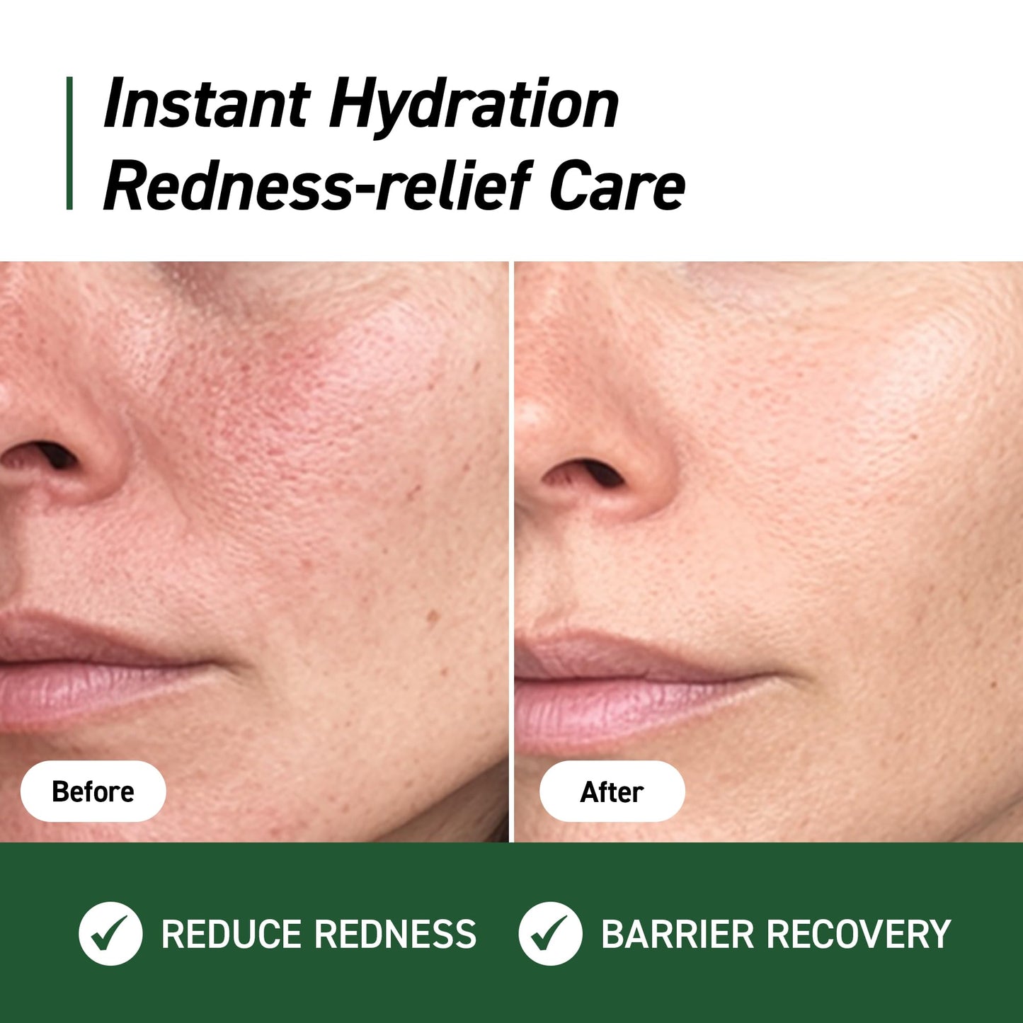 IVOSKIN Cica Redness Relief Treatment Cream, Soothing & Hydrating Green Correcting Moisturizer with Madecassoside, Helps Repair Skin Barrier for Sensitive Skin, Vegan, Korean Skincare (1.76oz / 50g)