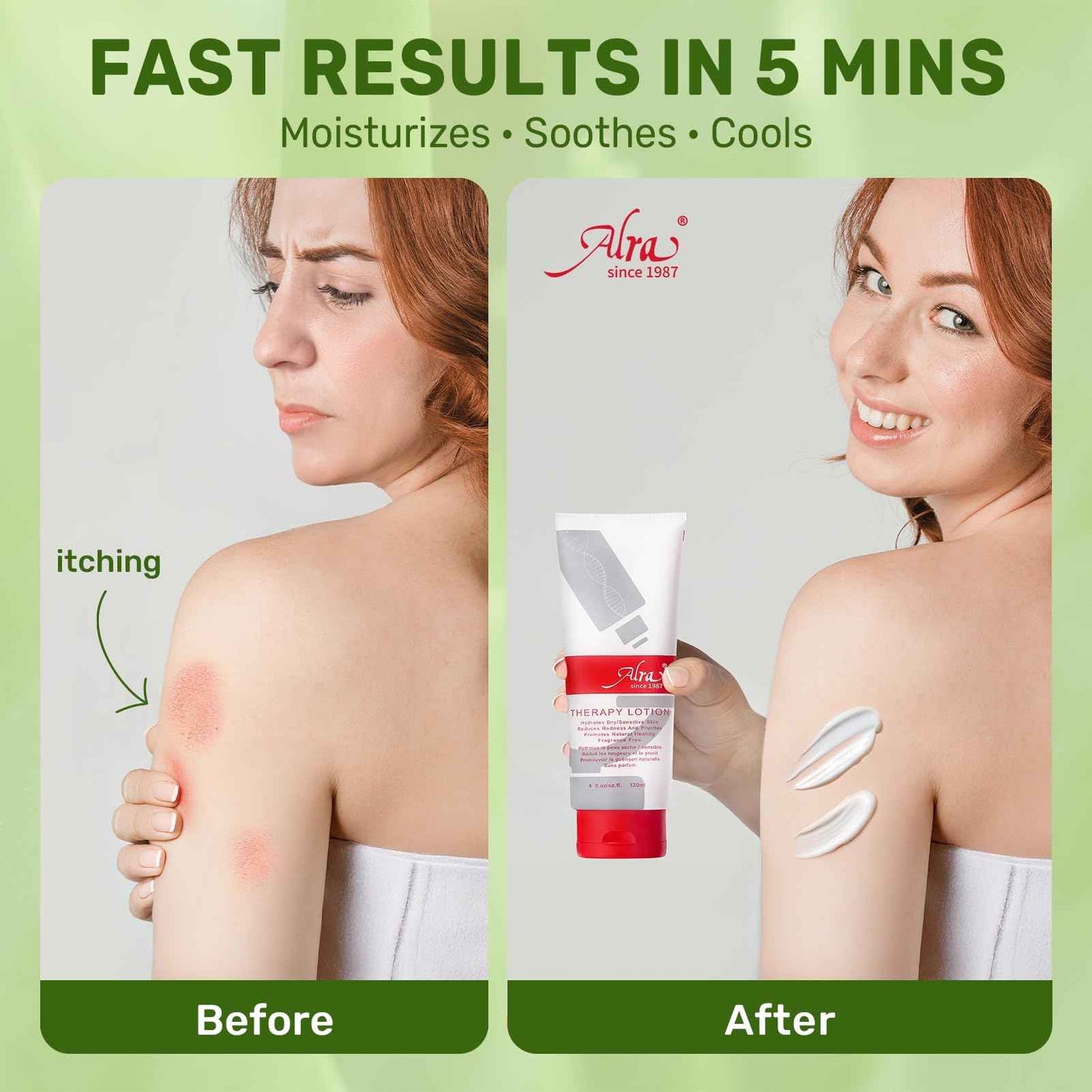 Alra Lotion for Extremely Dry Skin, Face, Hands & Body Cream Moisturizer with Aloe Vera Gel + Lanolin Oil + VE, Itch Relief, After Sun Lotion with Hydrate, Soothe, Cool Benefits, Fragrance free, 4 oz