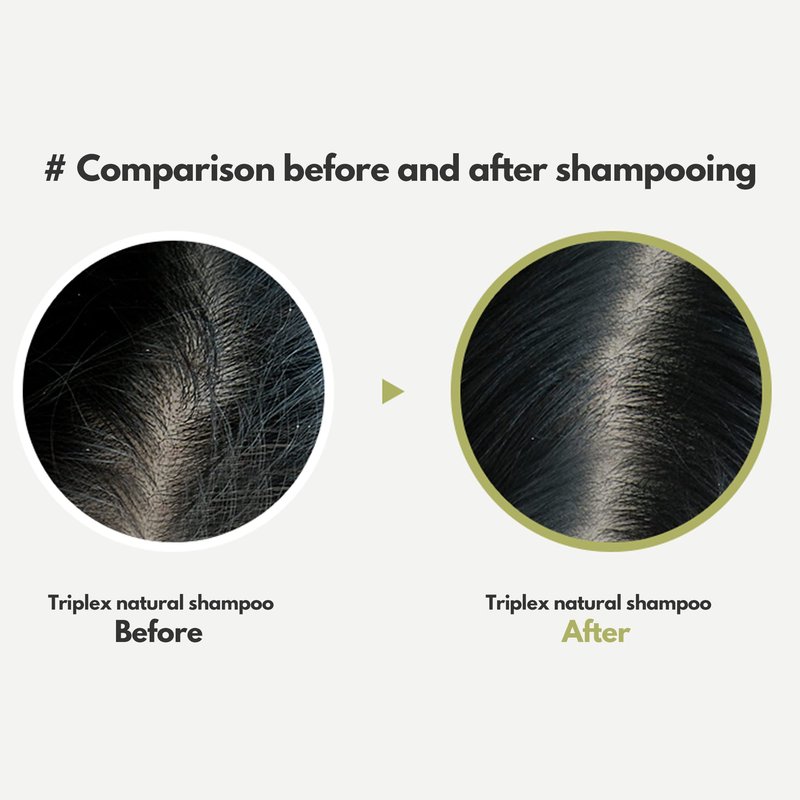 LA'DOR LADOR TripleX 3 Deep Cleansing Shampoo for Dry Itchy Sensitive Scalp Dandruff Naturally-derived Ingredients Tea Tree Lemon Lavender Sulfate-free Korean Hair Care