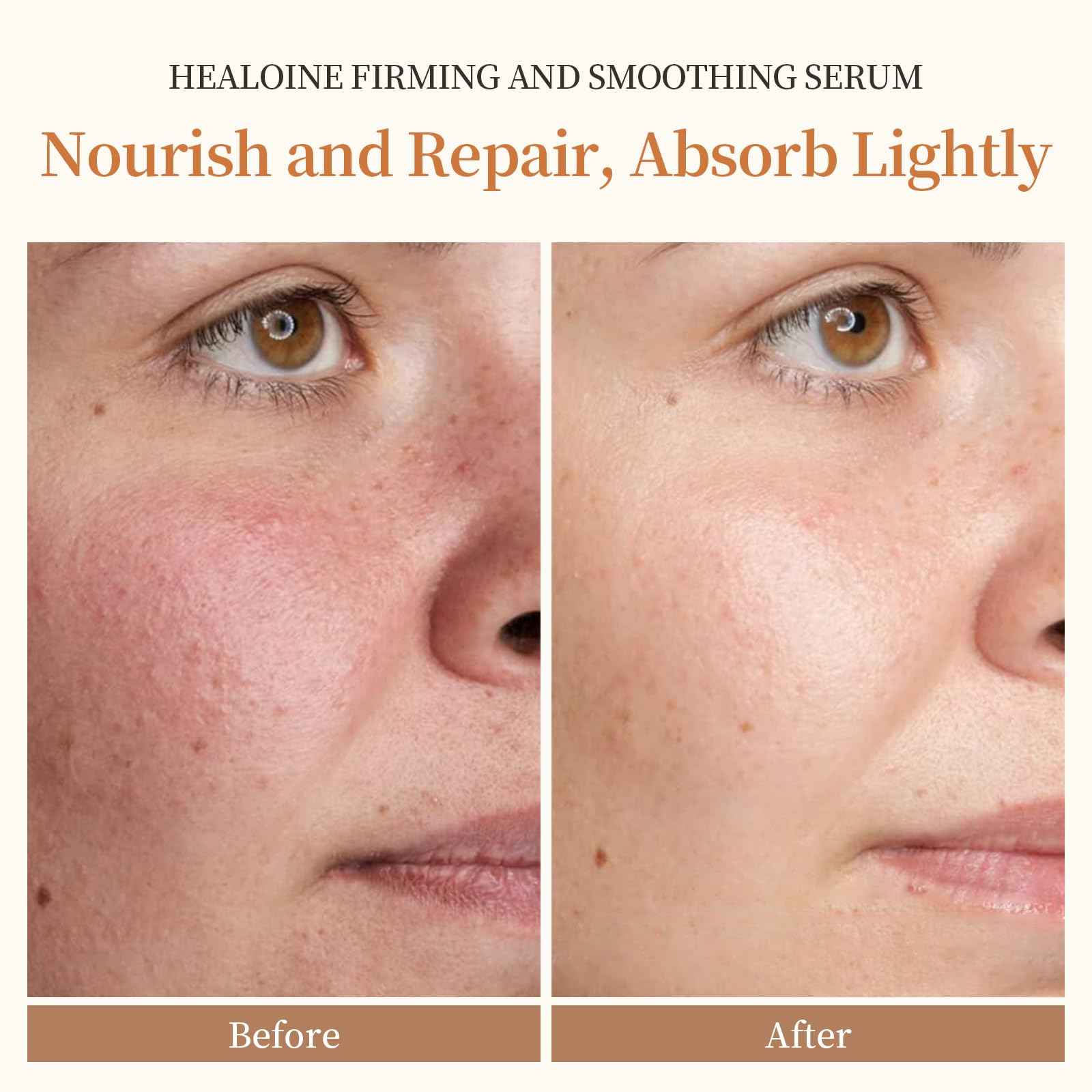 Healoine Double Peptides Serum for Face Niacinamide Hyaluronic Acid Power Repairing Essence Hydrating Serum for Face Filtrate for Dull Skin & Fine Lines, Korean Skin Care