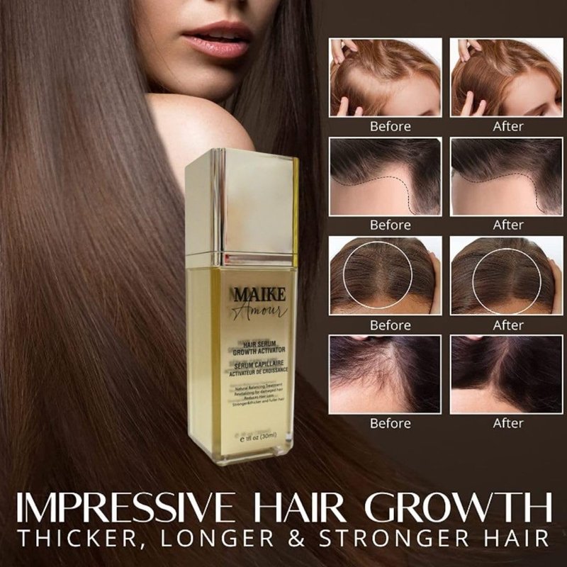 Scalp Serum Clinically Tested Non-Greasy Formula with Amino Acids, Biotin & Rosemary Oil Promotes Healthy Scalp & Fuller-Looking Hair, Reduces Oil & Product Buildup Hair Growth Serum