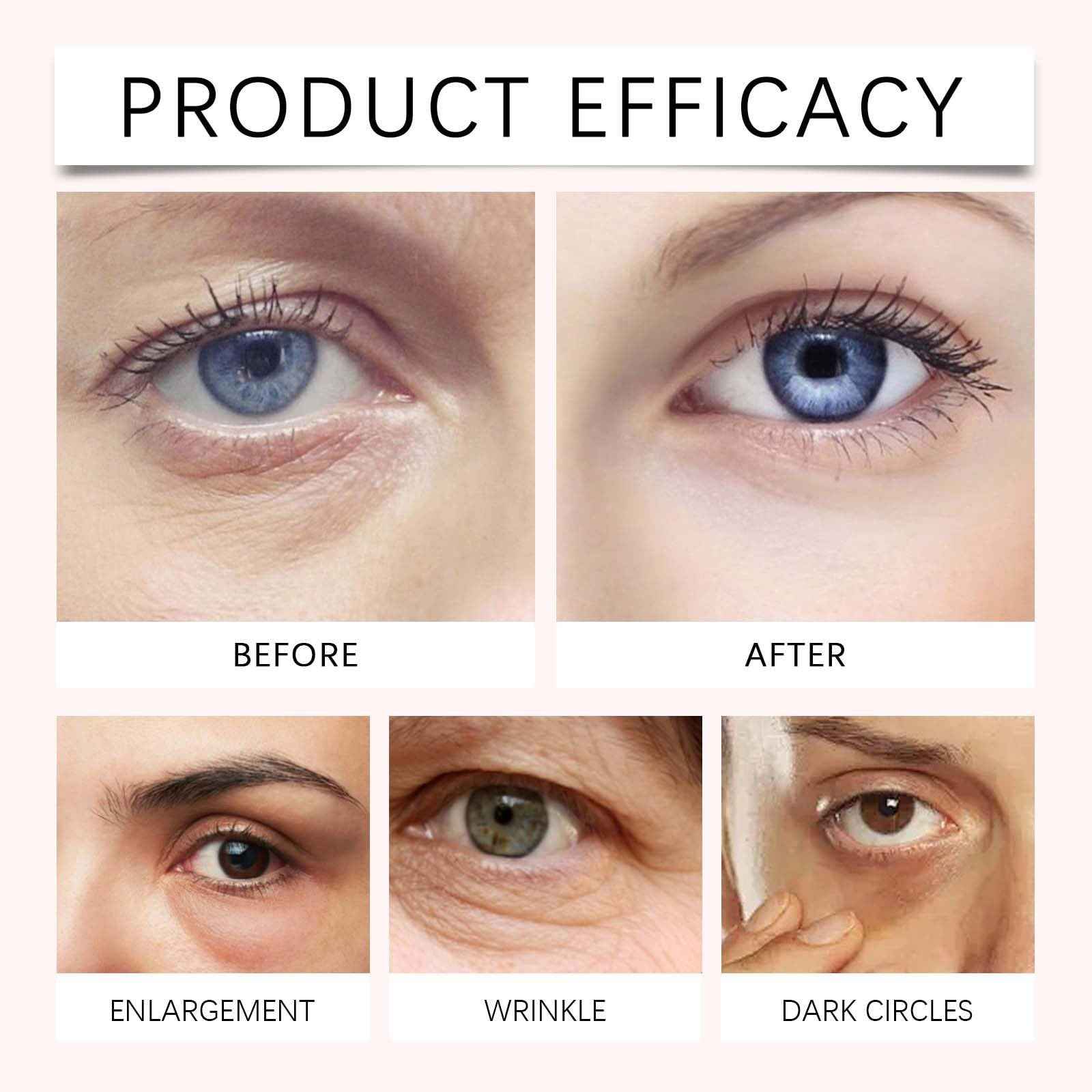 PDRN Pink Peptide Eye Serum Cream, Hydrating & Firming Eye Cream for Dark Circles, Anti-Aging Treatment Reduces Fine Lines, Uneven Skin Tone, Soothing Pink Moisturizer with Peptides, 1.01fl.oz (3)