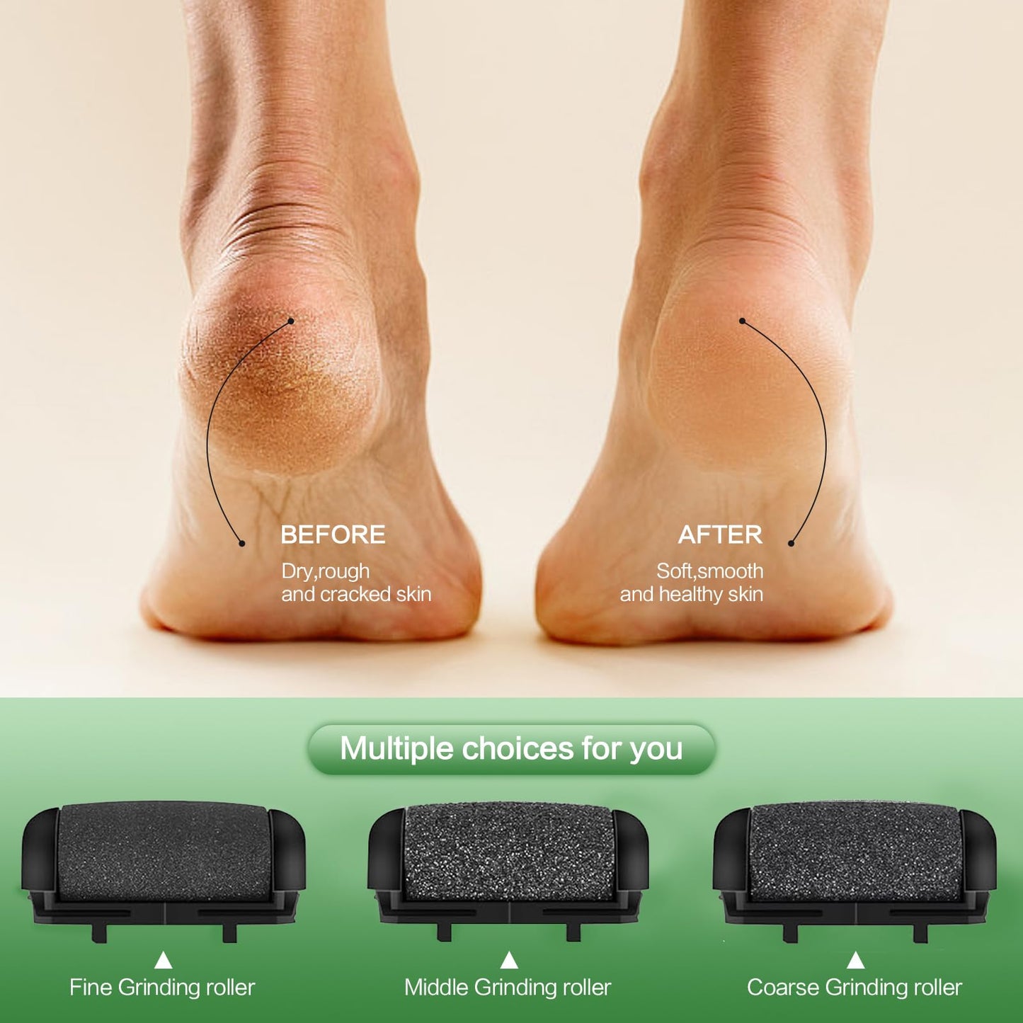 Sokadanch Electric Foot File Pedicure Feet Hard Skin Remover Foot Scraper Dry Dead Skin Remover Callus Exfoliator Rechargeable Feet Scrubber with 3 Replacement Rollers Foot Care Skin Removers, Black