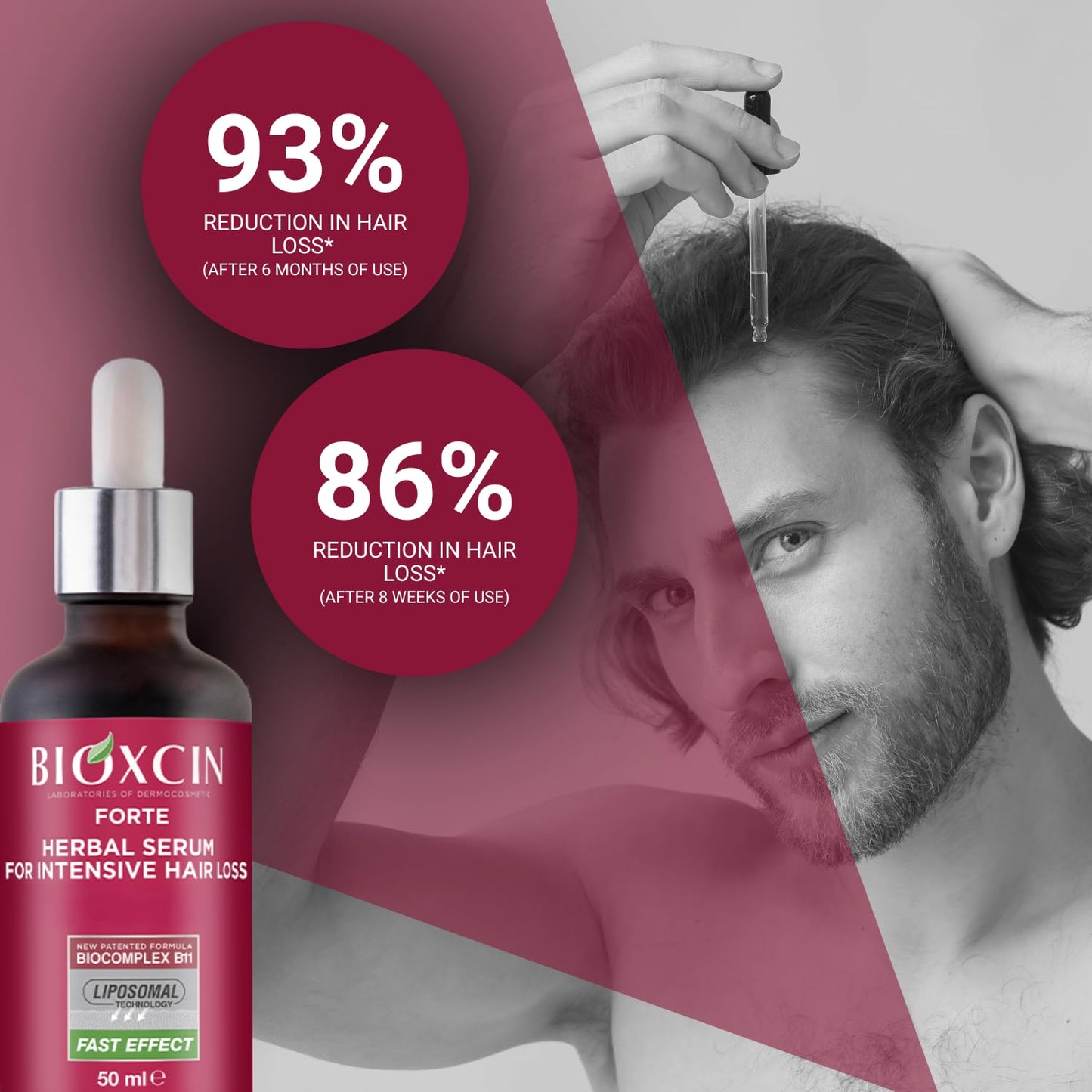 Anti-Hair Loss Serum - Biotin & Keratin Hair Oil Treatment for Thinning Hair | Nourishing Scalp Serum, 3 x 50 ML