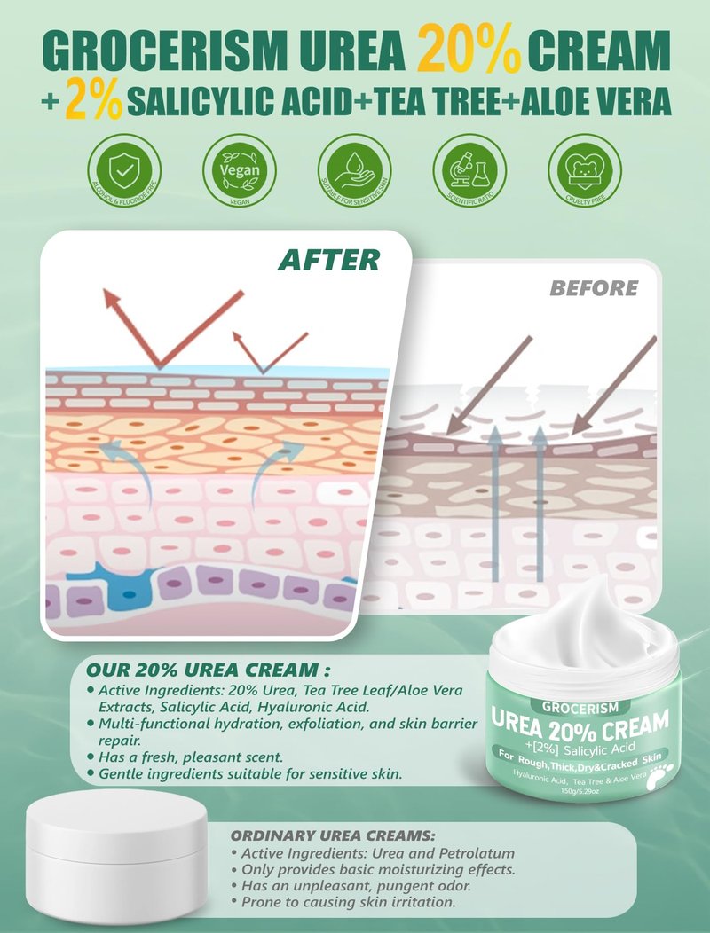 Urea Cream 20 Percent For Feet Plus 2% Salicylic Acid 150g || Foot Cream and Hand Cream Maximum Strength with Hyaluronic Acid, Tea Tree, and Aloe Vera for Deep Moisturizes