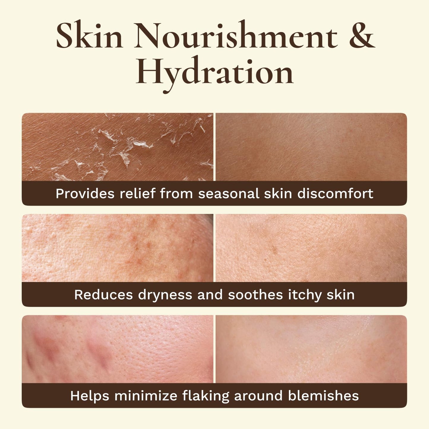 Beef Tallow Face Moisturizer - Whipped Grass-Fed Balm with Raw Honey & Beeswax | Hydrating Cream for Dry, Sensitive Skin