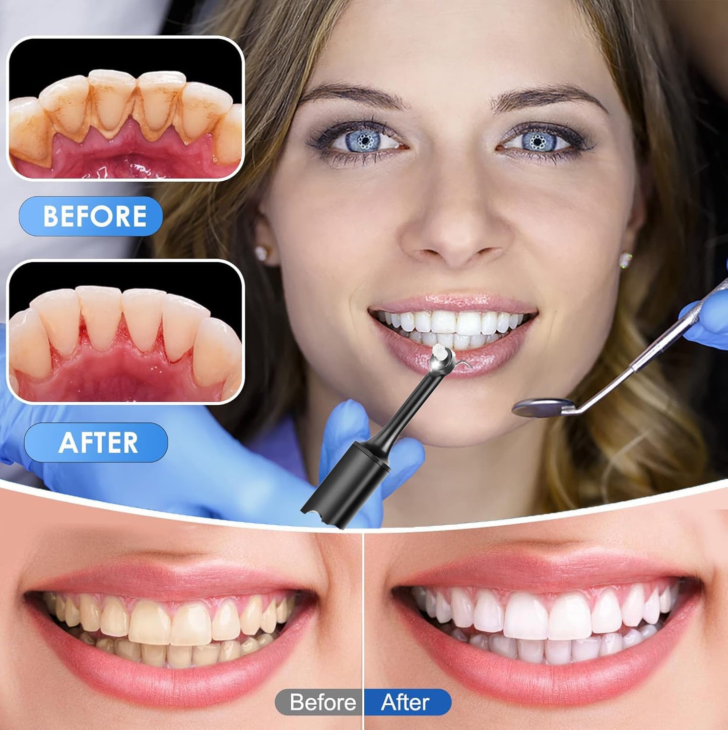 Tooth Polisher,Teeth whitening kit 12 Pieces Accessories，Teeth Polishing Kit for Daily Cleaning,Polishing Then Whitening kit