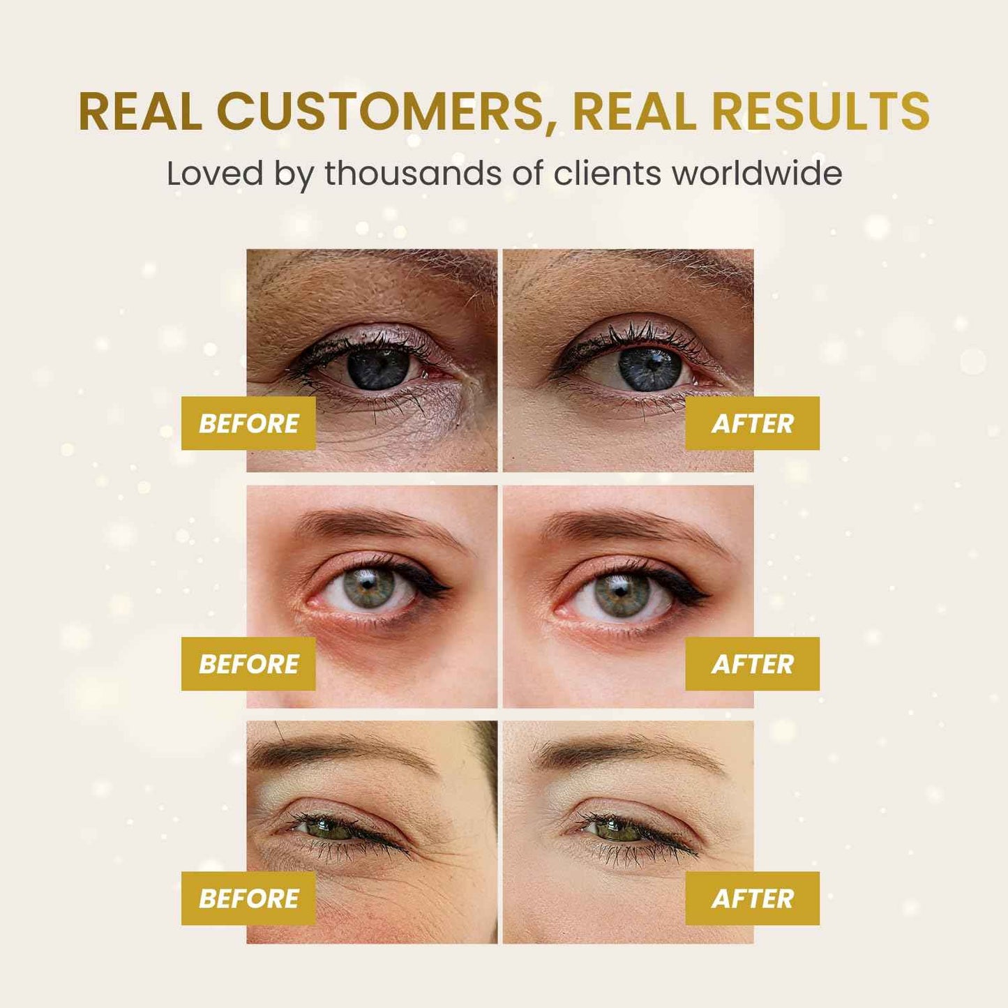 PLANTIFIQUE Gold Eye Patches for Puffy Eyes | 30 Pairs | Gifts | Under Eye Masks for Dark Circles | Puffiness Eye Gels | Eye Mask Skincare