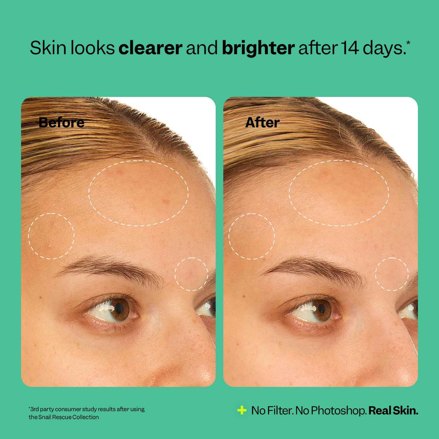 Peach Slices - Snail Rescue Intensive Serum (1.01 oz) - 95% Snail Mucin Concentrate - Reset, Renew & Smooth - Birch Juice, Hyaluronic Acid & Cica - Vegan & Cruelty Free - Korean Skin Care & Beauty