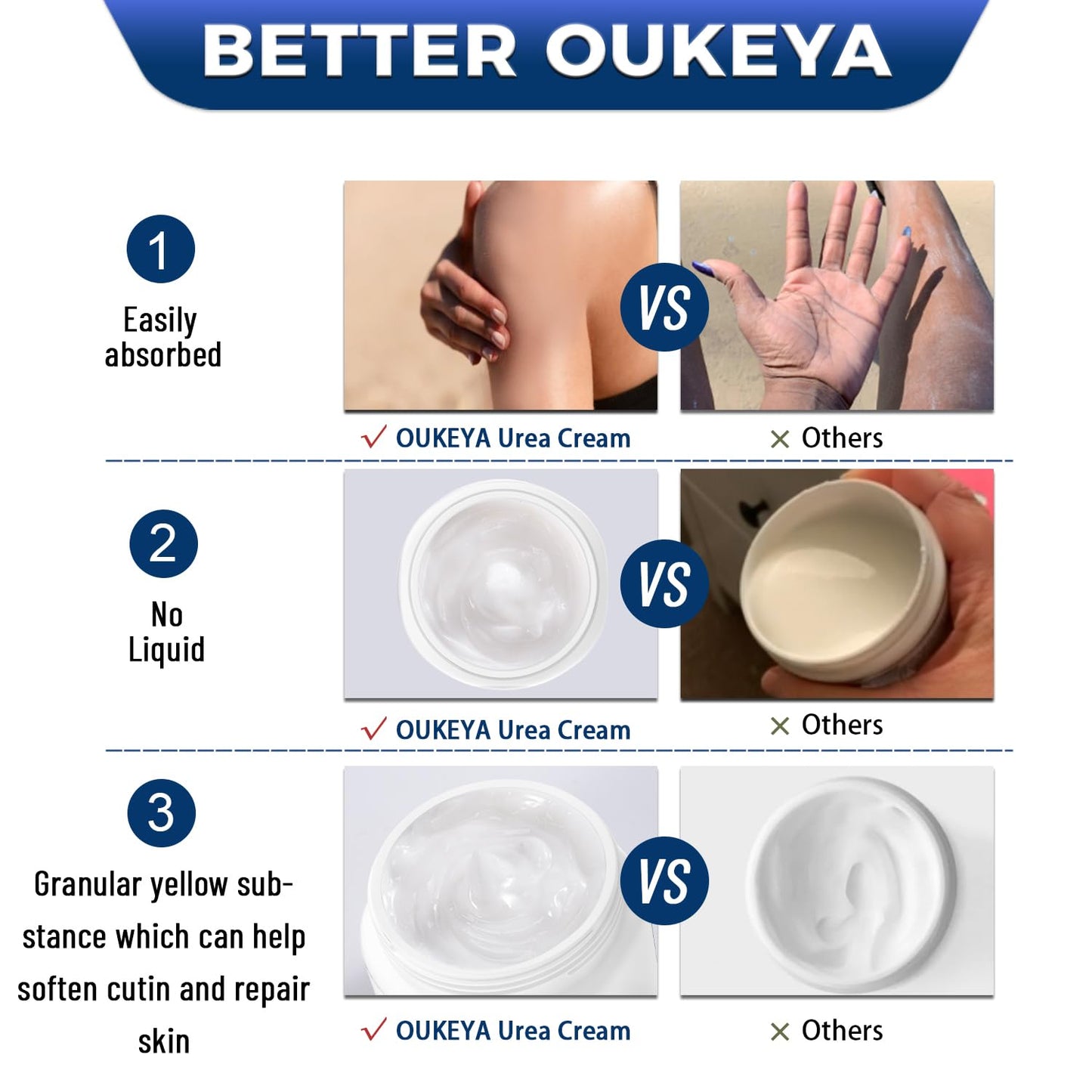 OUKEYA Urea Cream 40% with 2% Salicylic Acid Intensive Foot, Hand & Body Cream for Very Dry, Cracked, Rough Skin on Heels, Knees & Elbows (12.35 Ounce)