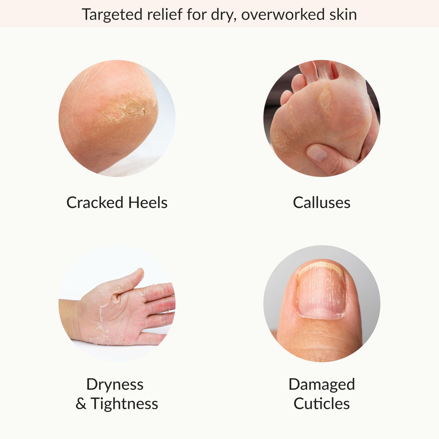 Epielle Hydrating & Moisturizing Hand & Foot Masks, Relieve and Soften Dry, Rough Skin, Self Care Gifts for Women, Spa Kit, 6 Moisturizing Gloves & 6 Moisturizing Socks