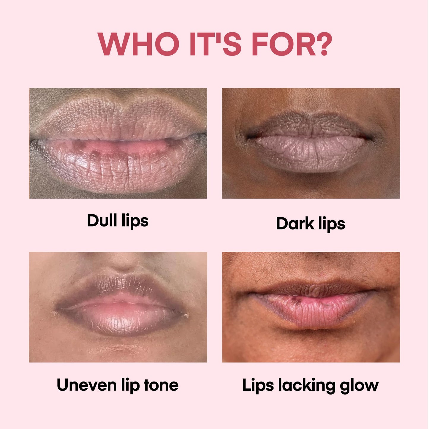 KissBea Lip Lightening for Dark Lips: for Smokers, Dry or Uneven-Toned Lips – Restores Natural Look & Moisture with VC, Lemon Peel & Licorice – Refreshing Strawberry Scent – 15 mL