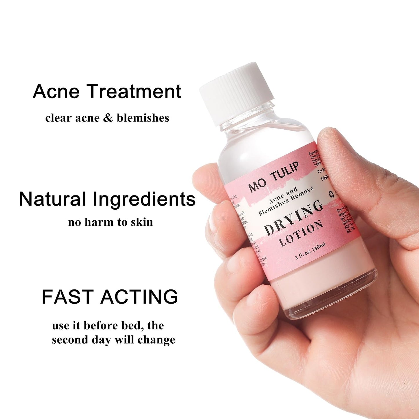 MO TULIP Acne Drying Lotion, Overnight Acne Acid and Acne Spot Treatment for Face and Body, Pimple Lotion Spot Treatment, Dry Out Pimples, Blemishes, and Clean pores (1OZ)