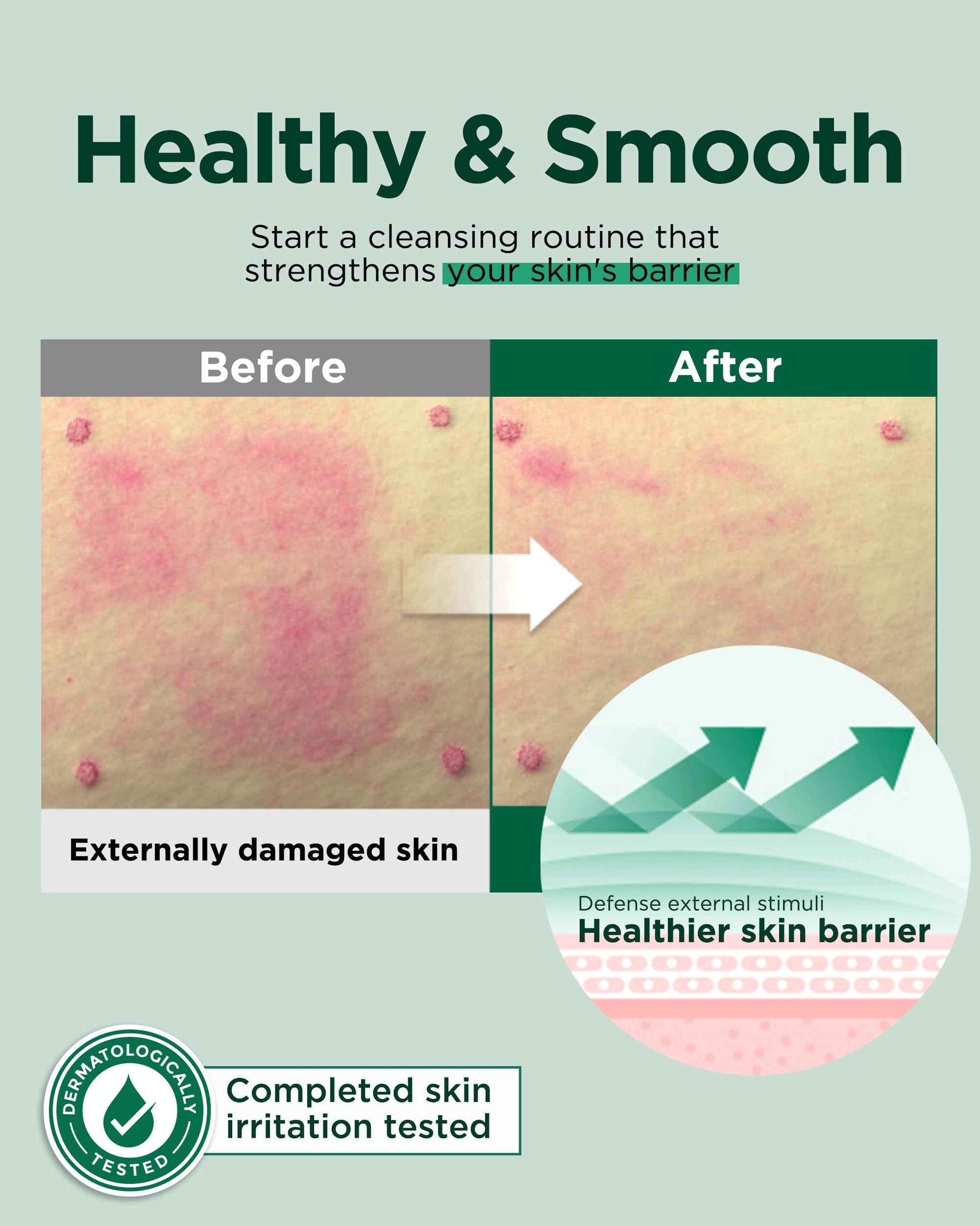 EASYDEW Barrier Repair Cream - Intense Hydration and Skin Barrier Restoration Face Moisturizer for Damaged and Irritated Skin with Cica, Hyluronic Acid, Collagen, 1.01 fl.oz.