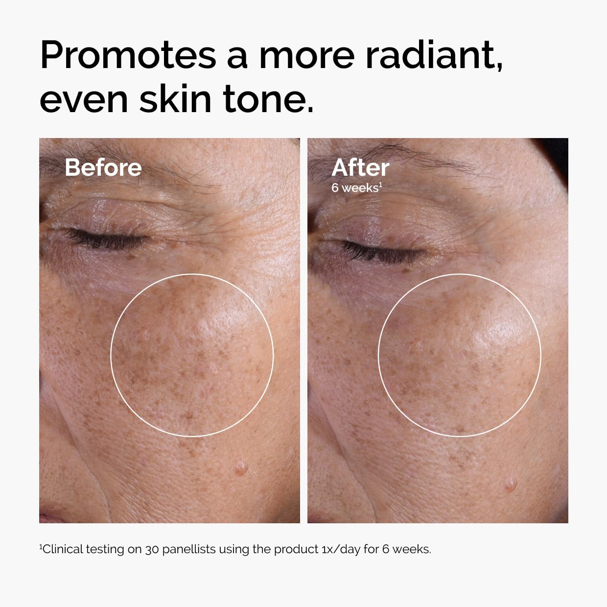 The Ordinary Glycolic Acid 7% Exfoliating Toner - Brightening & Smoothing Daily Formula for Even Skin Tone
