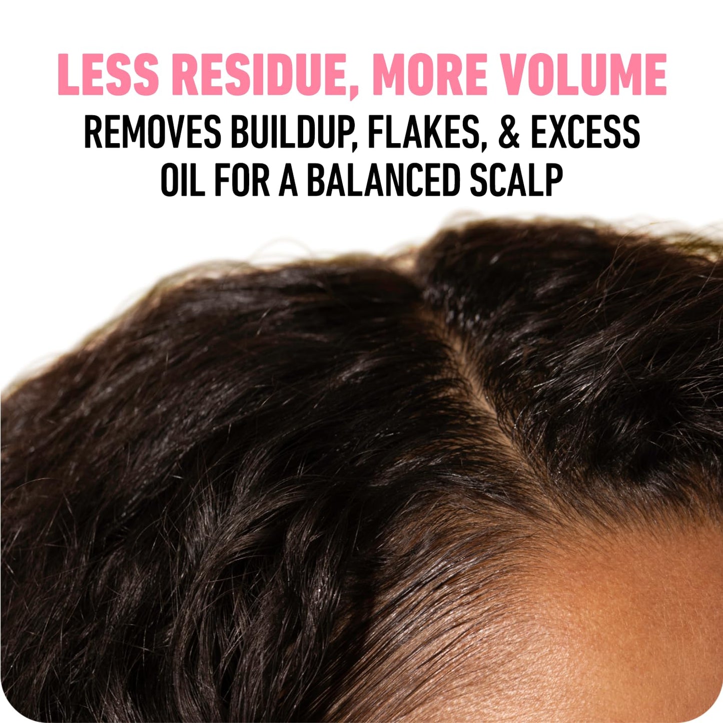 BOLDIFY Scalp Scrub - Sulfate-Free Hair Exfoliating Treatment for Growth & Detox | 8 oz