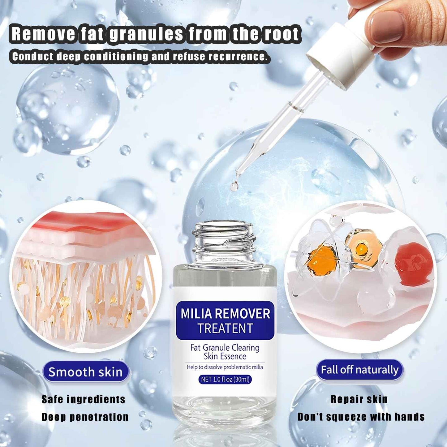 Dermfree Milia Remover Treatment, Milia Spot Treatment with Salicylic Acid Milia Acne Serum Clearing Skin Essence(30ML)