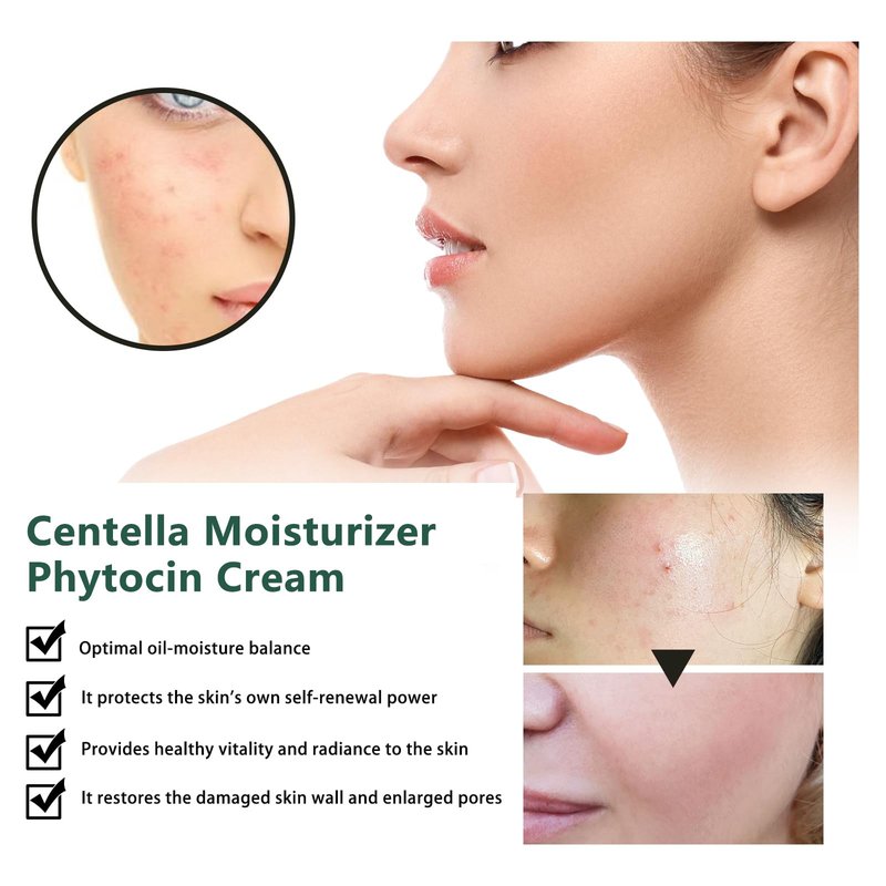 YAMFIUY Centella Moisturizer Phytocin Cream - Phytocin Cream, Moisturizer & Hydration, Improve Roughness, Smooth Skin, For Sensitive Skin with Natural Centella Asiatica Extract 2pcs