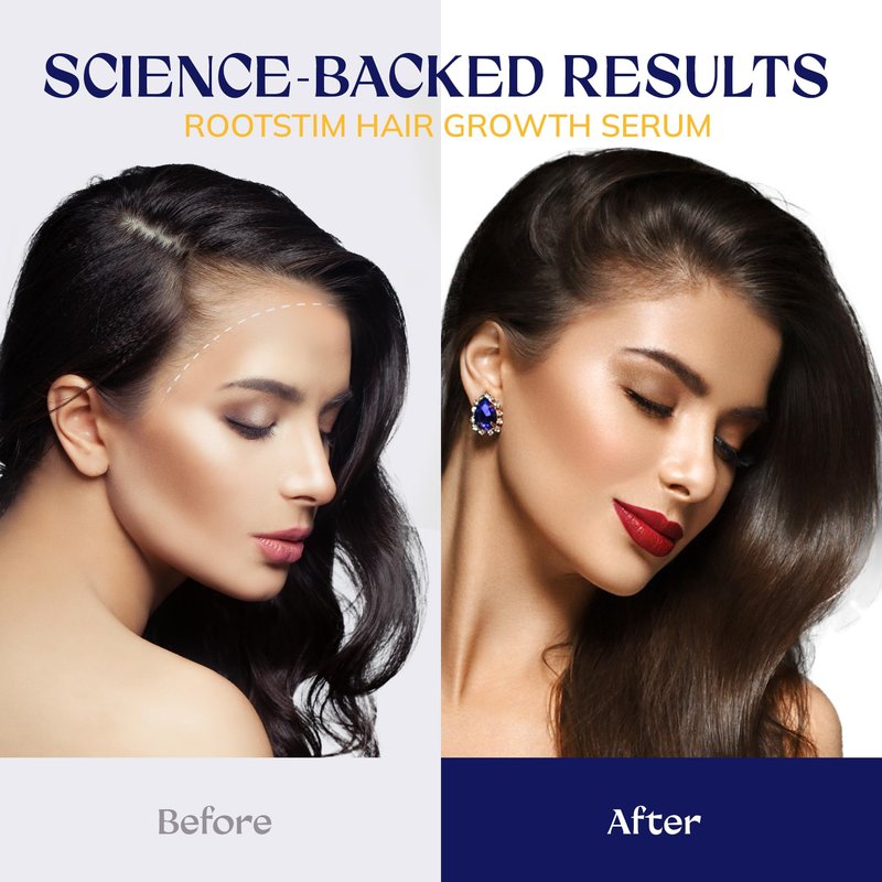 RootStim Hair Growth Serum for Men & Women, Hair Growth Spray, Rice Water & Biotin & Caffeine - Hair Oils for Hair Growth -Longer, Fuller Hair