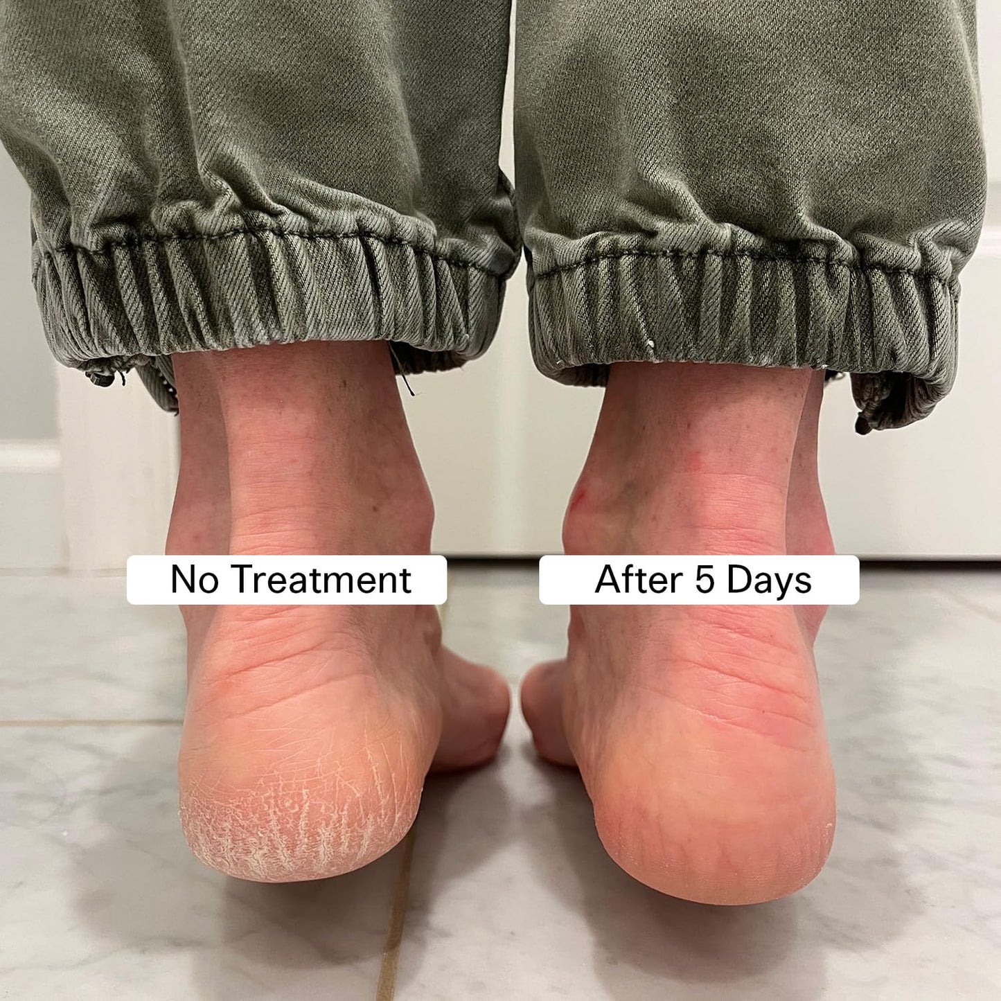 Pedestrian Project Cracked Heel Repair Foot Care Balm, Smooths & Fills Cracks & Rough Skin with Healing Shea & Mango Butters, Vegan, Cruelty Free, 1 oz