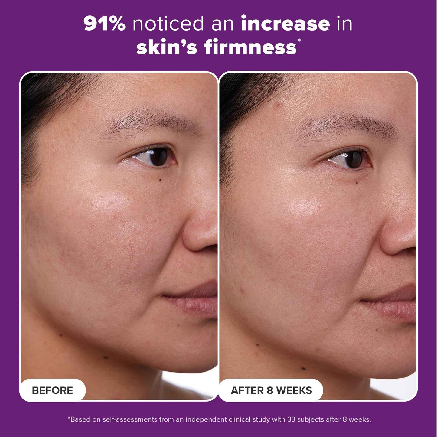 Paula's Choice CLINICAL 1% Retinol Treatment Cream with Peptides, Vitamin C & Licorice Extract, Anti-Aging & Wrinkles, Travel Size. PACKAGING MAY VARY.