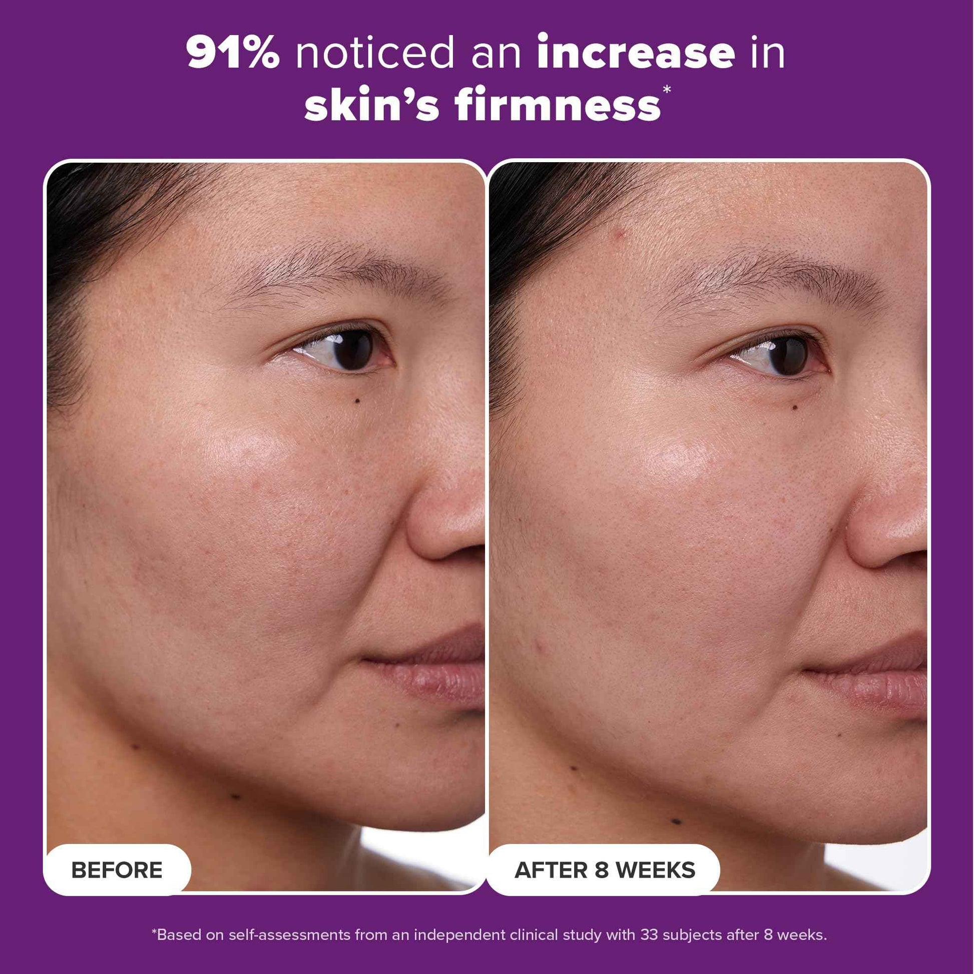 Paula's Choice CLINICAL 1% Retinol Treatment Cream with Peptides, Vitamin C & Licorice Extract, Anti-Aging & Wrinkles, Travel Size. PACKAGING MAY VARY.