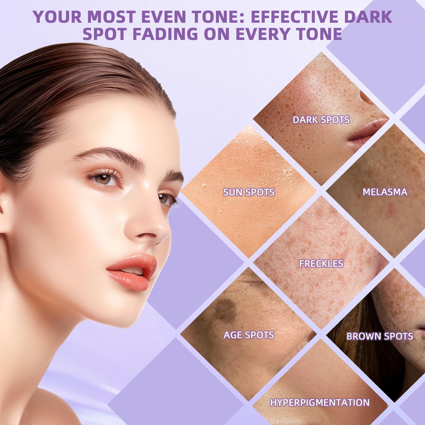 Dark Spot Remover for Face & Body, Corrects Sun Spots, Age Spots & Acne Marks, Skin Lightening Cream for Intimate Areas, Knees, Bikini Line, Tone Repair Formula for Women & Men (1.7 Fl Oz)