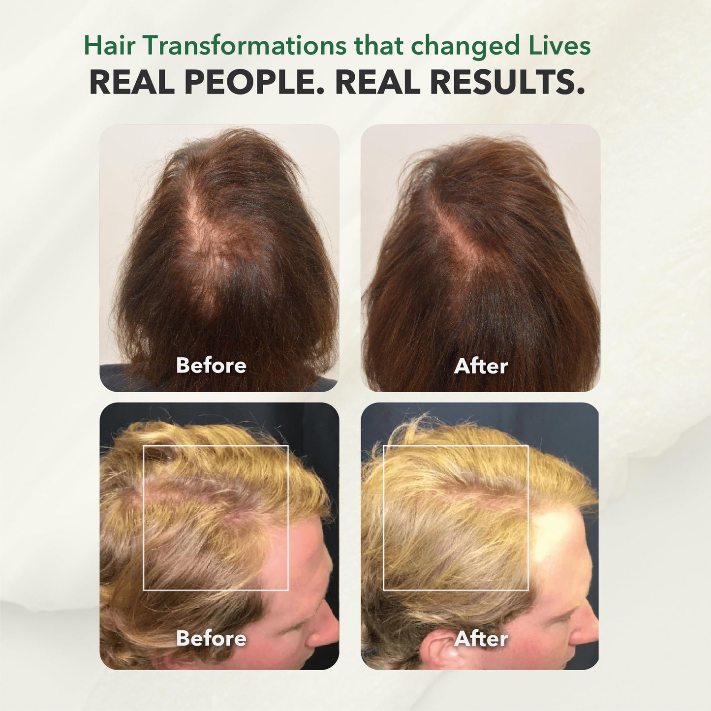 HairSmart Hair Growth Shampoo with Ginger, Amla & Neem | Shampoo for Thinning Hair | Hair Growth Products, 100ml