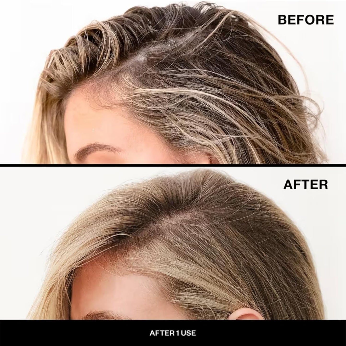 IGK First Class Charcoal Detox Dry Shampoo - Oil Absorbing & Volumizing Spray for Brunette/Blonde Hair | 6.3 oz